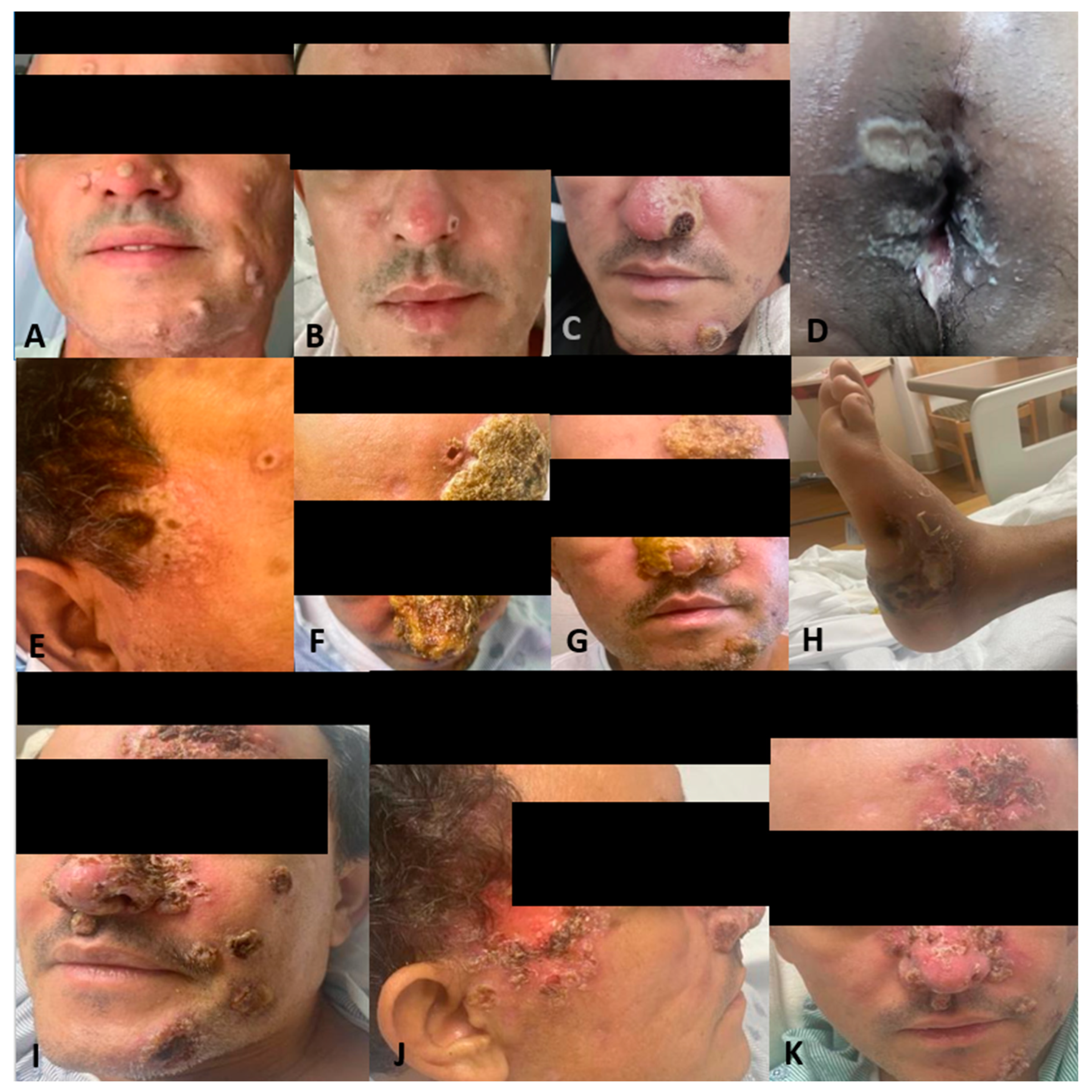 Vaccines 11 00650 g001