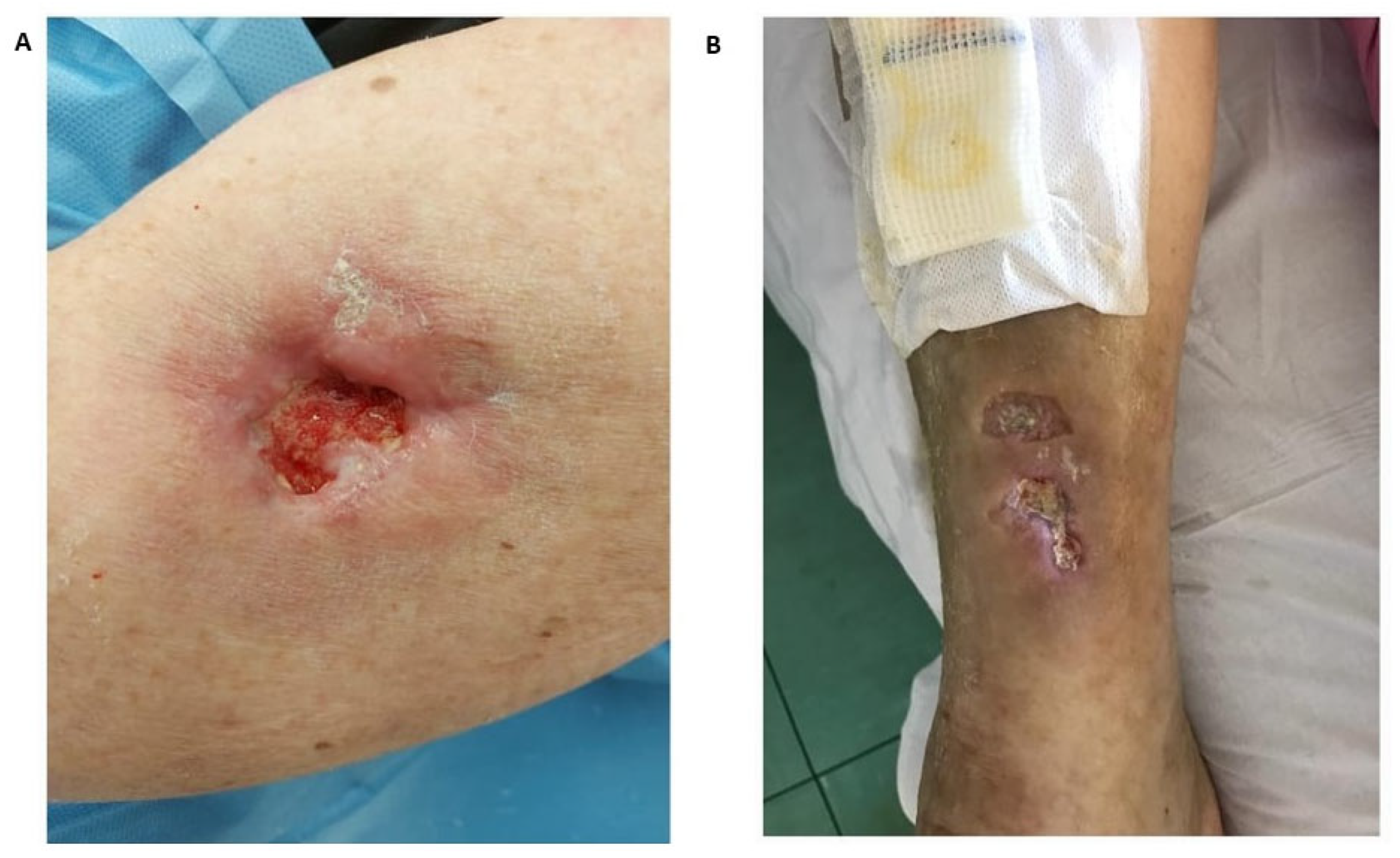 Vaccines 11 00898 g001