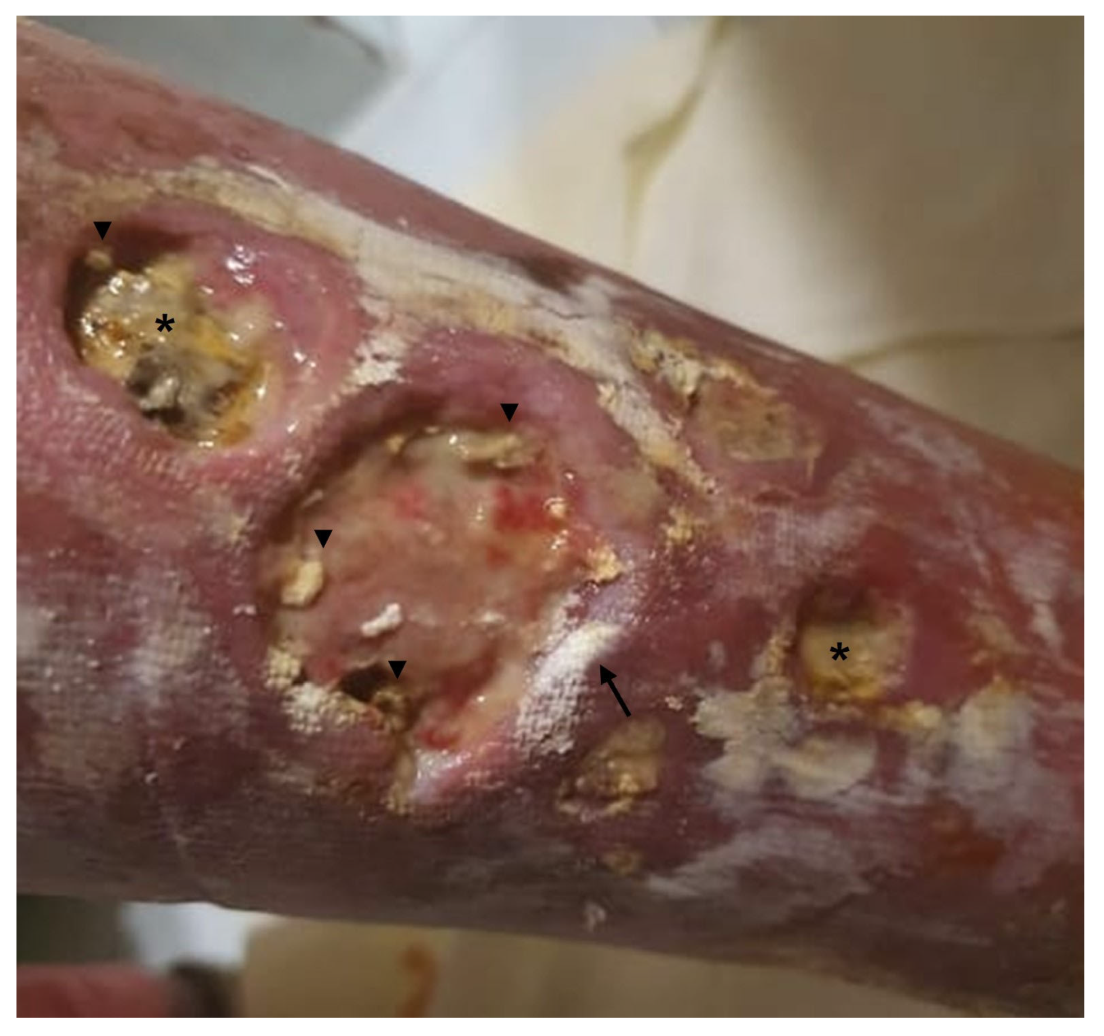 Vaccines 11 00898 g002