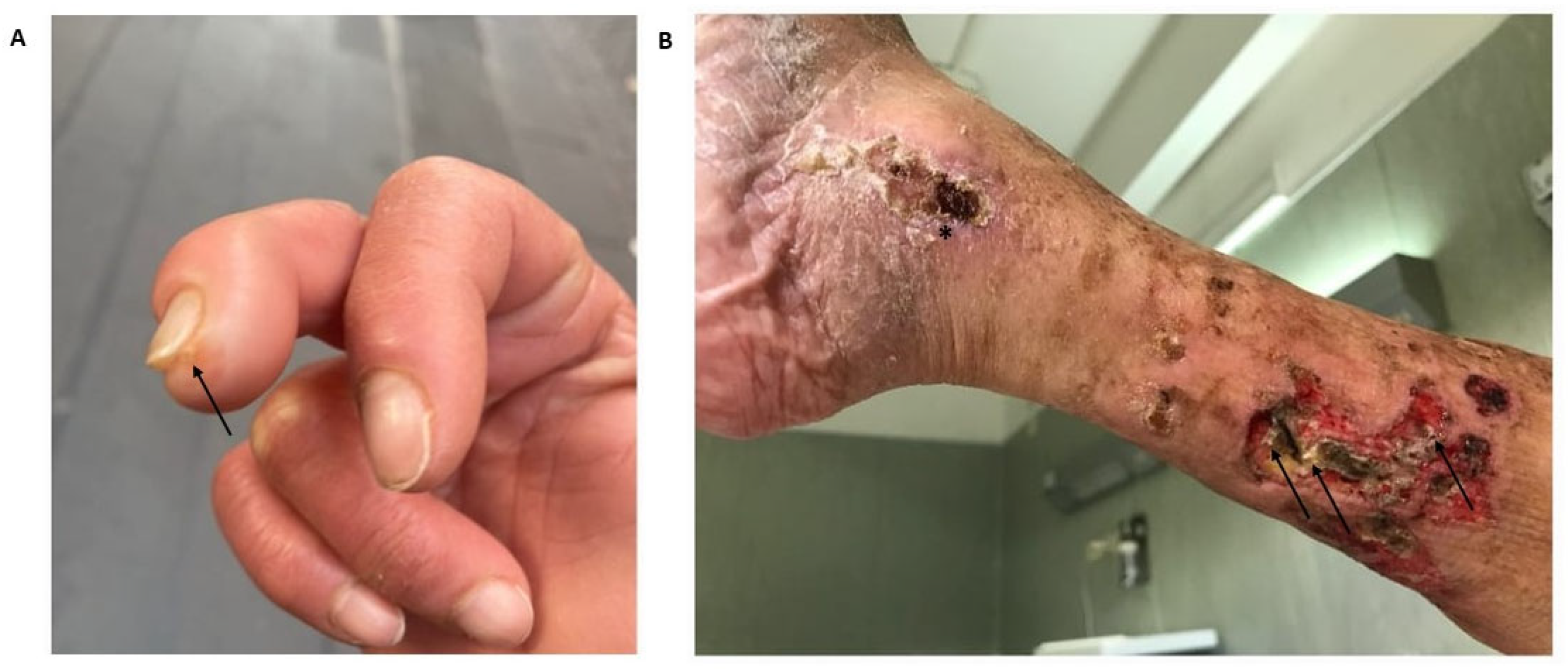 Vaccines 11 00898 g003