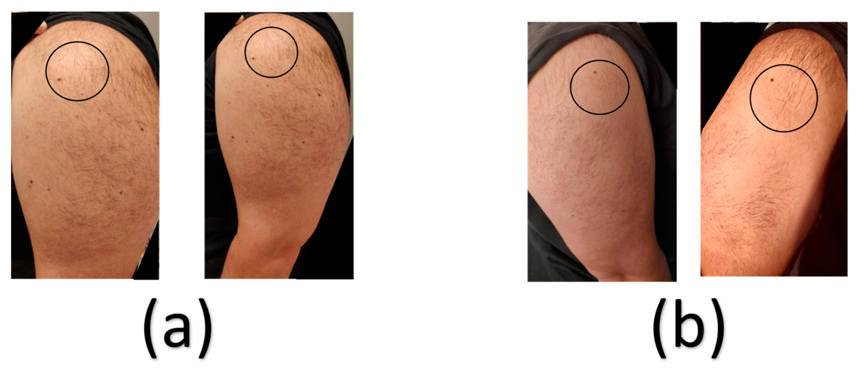 Vaccines 11 00950 g001