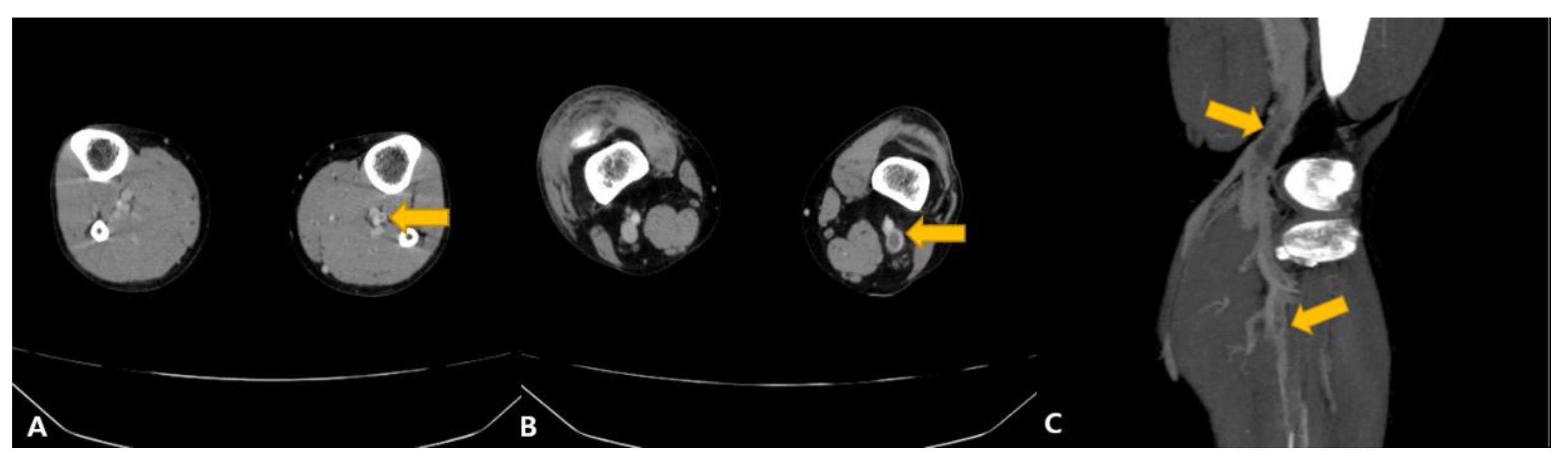 Vaccines 11 01075 g002