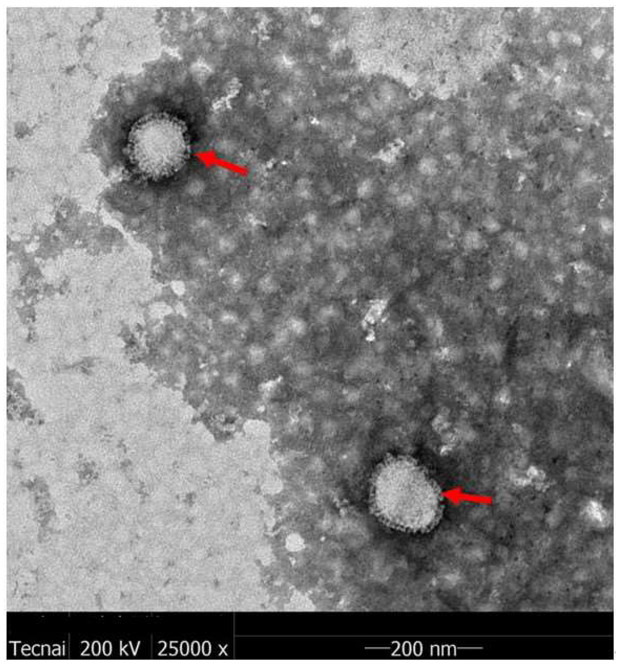 Vaccines 12 00138 g007