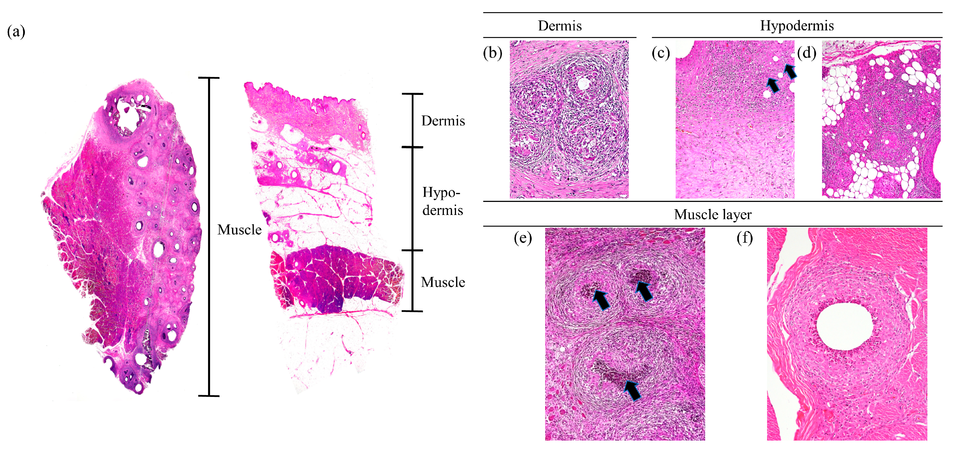 Vaccines 12 00190 g003