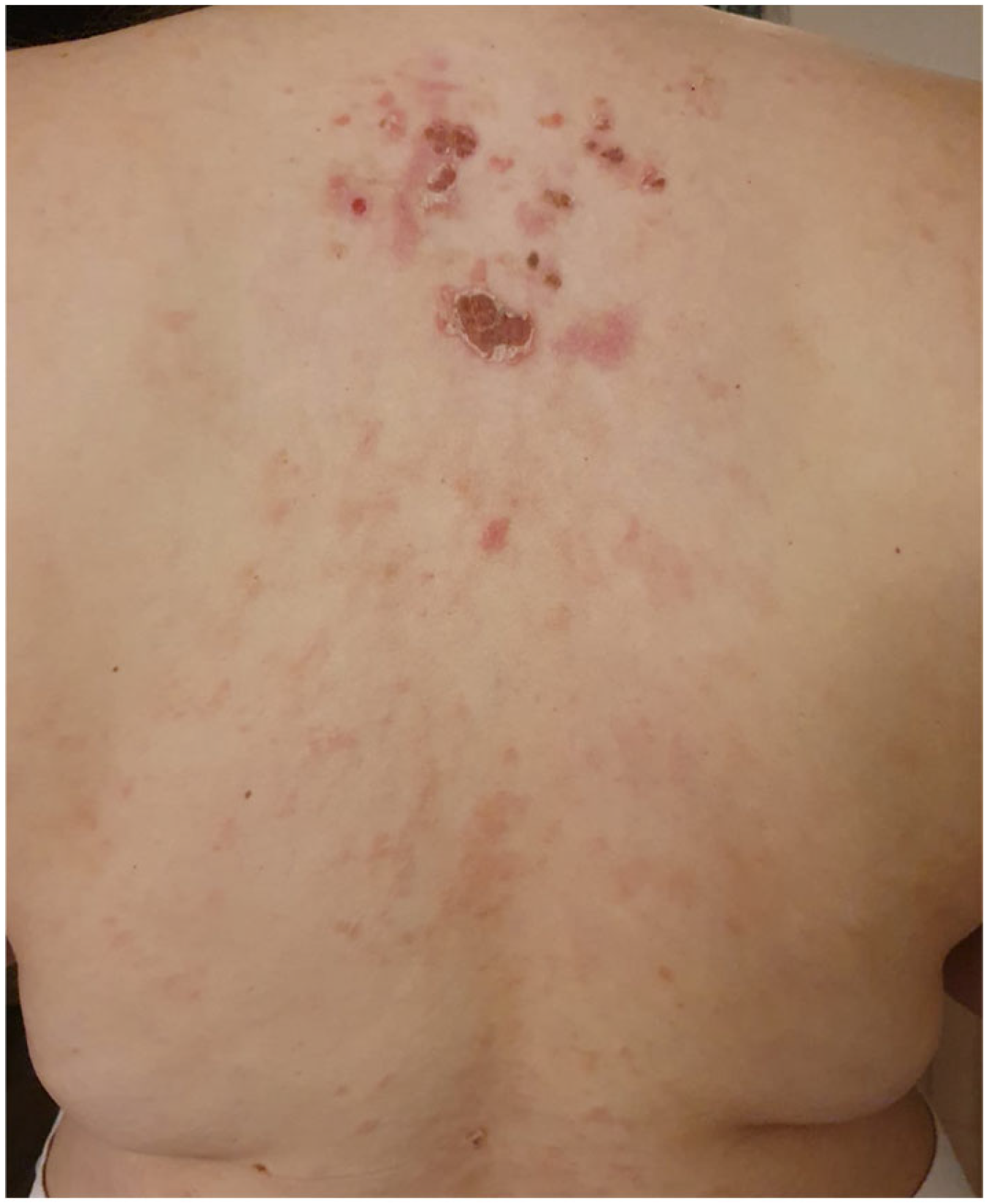 Vaccines 12 00857 g001