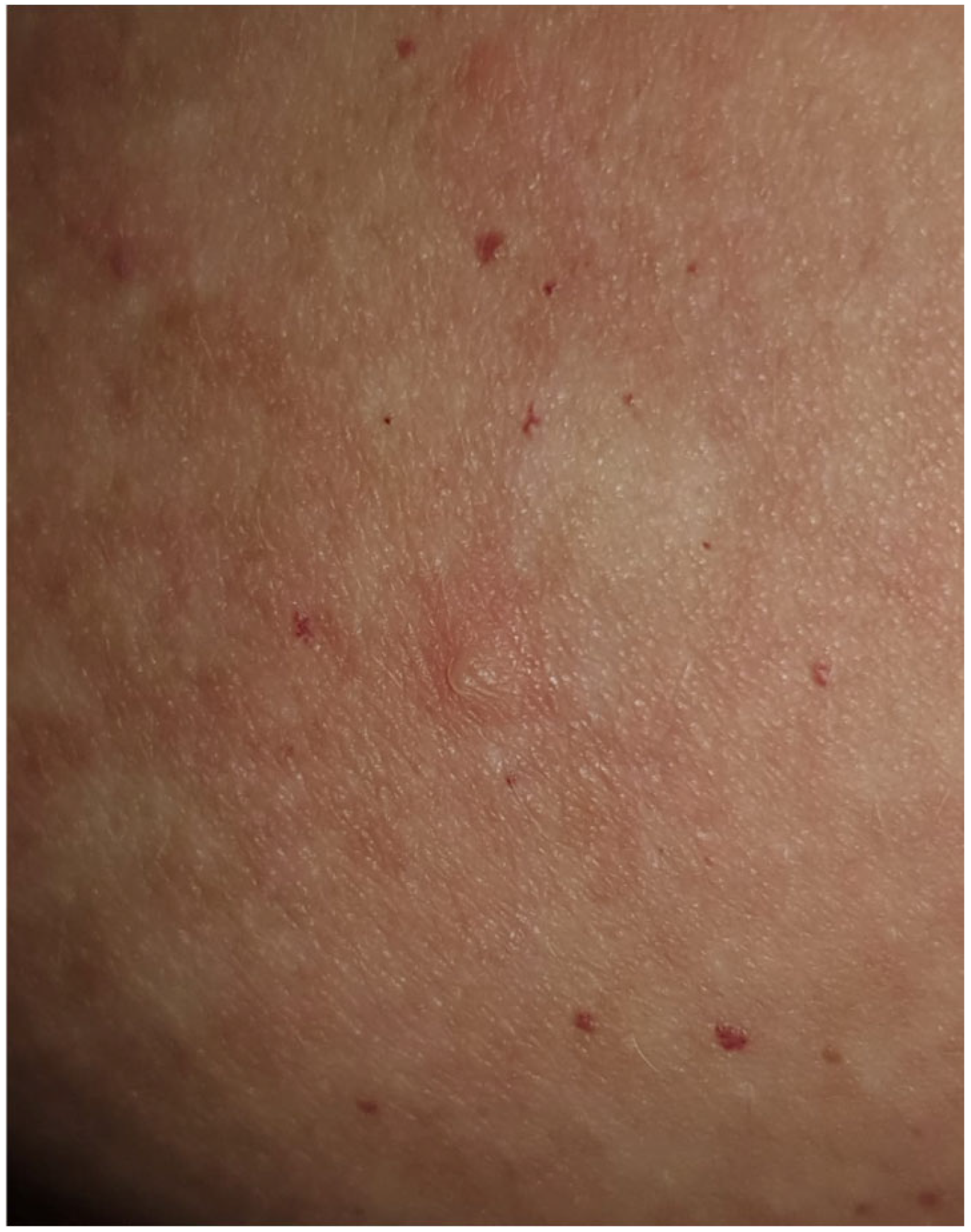 Vaccines 12 00857 g003