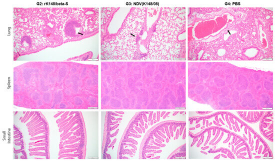 Vaccines 12 00921 g004