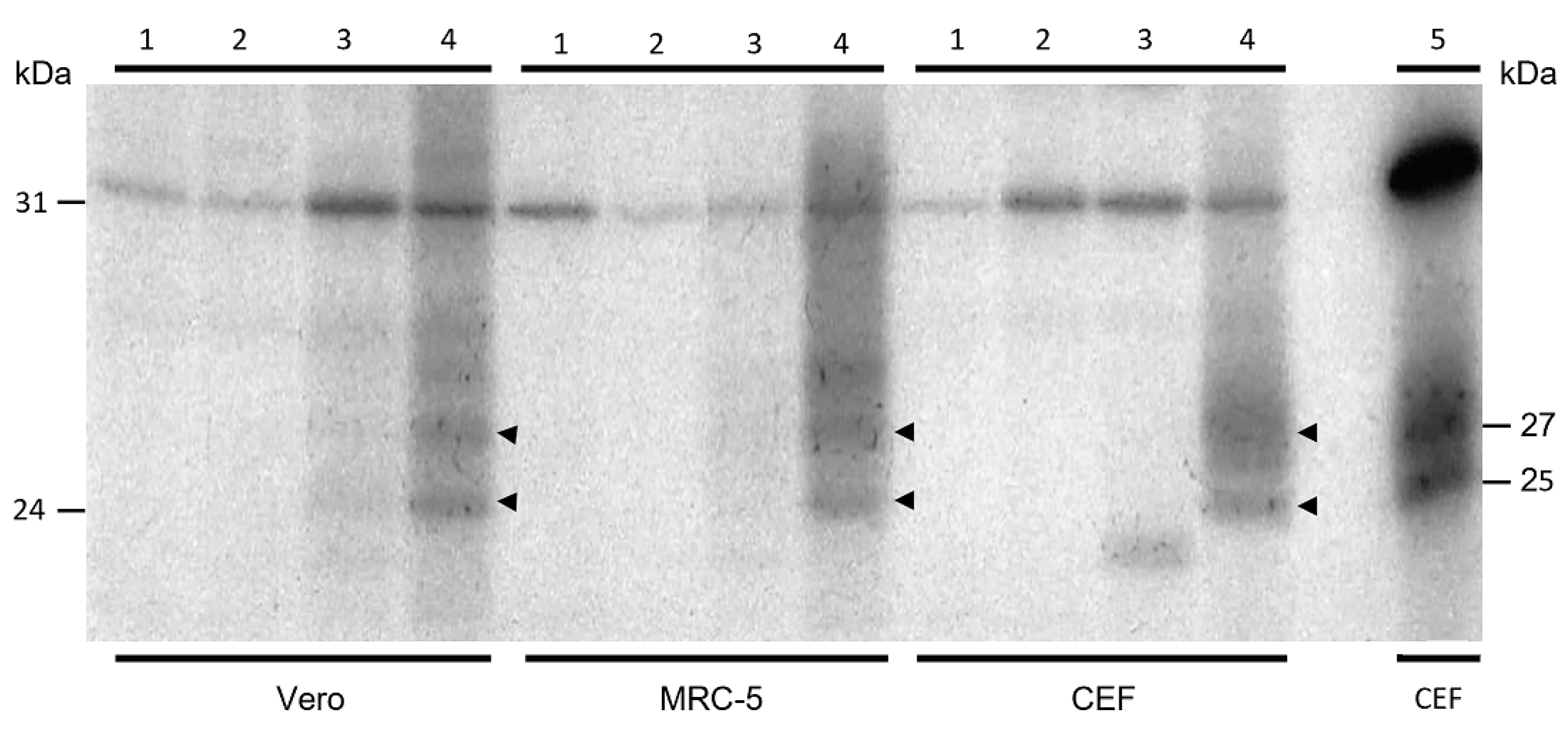 Vaccines 12 01115 g003