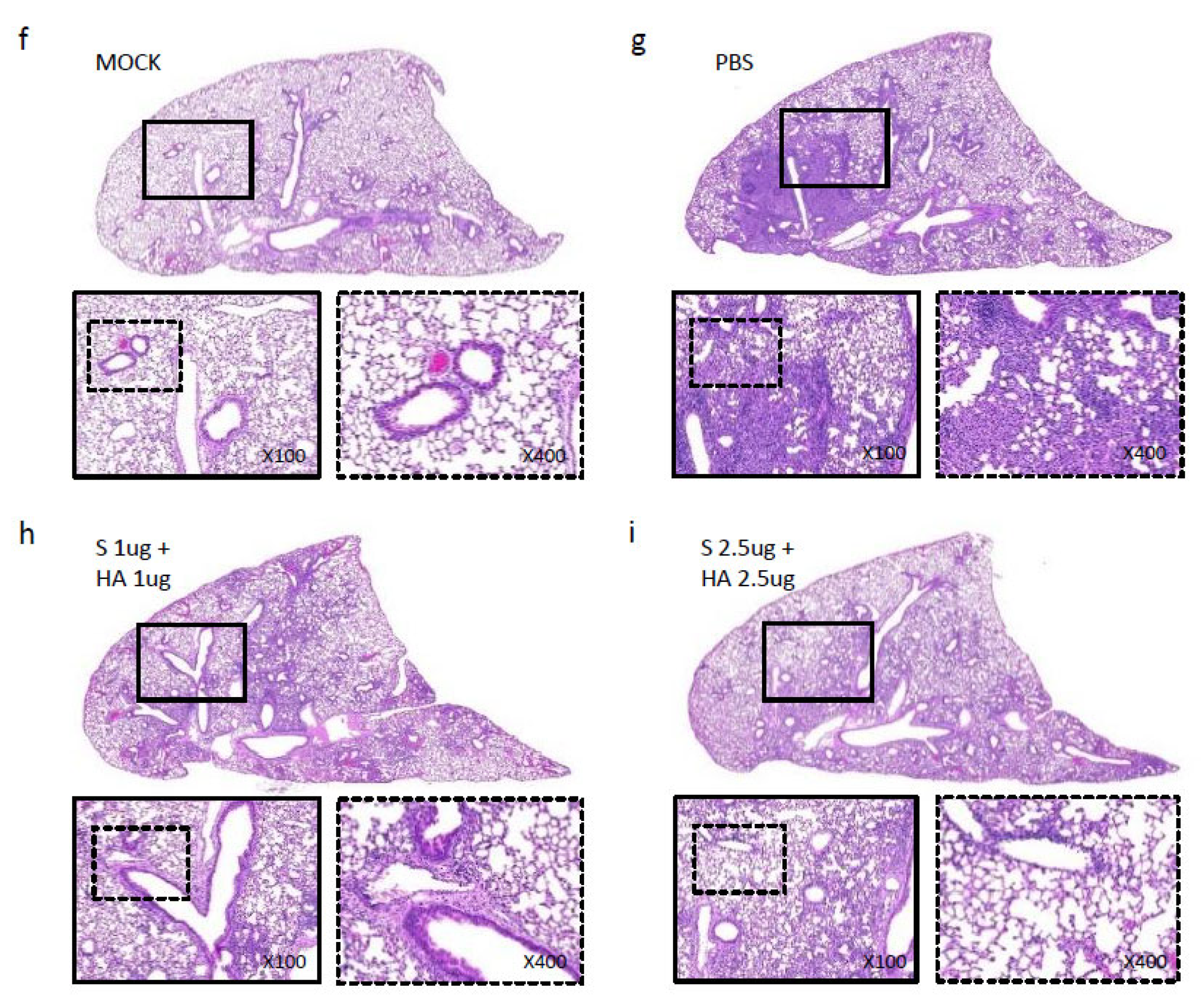 Vaccines 13 00254 g006b