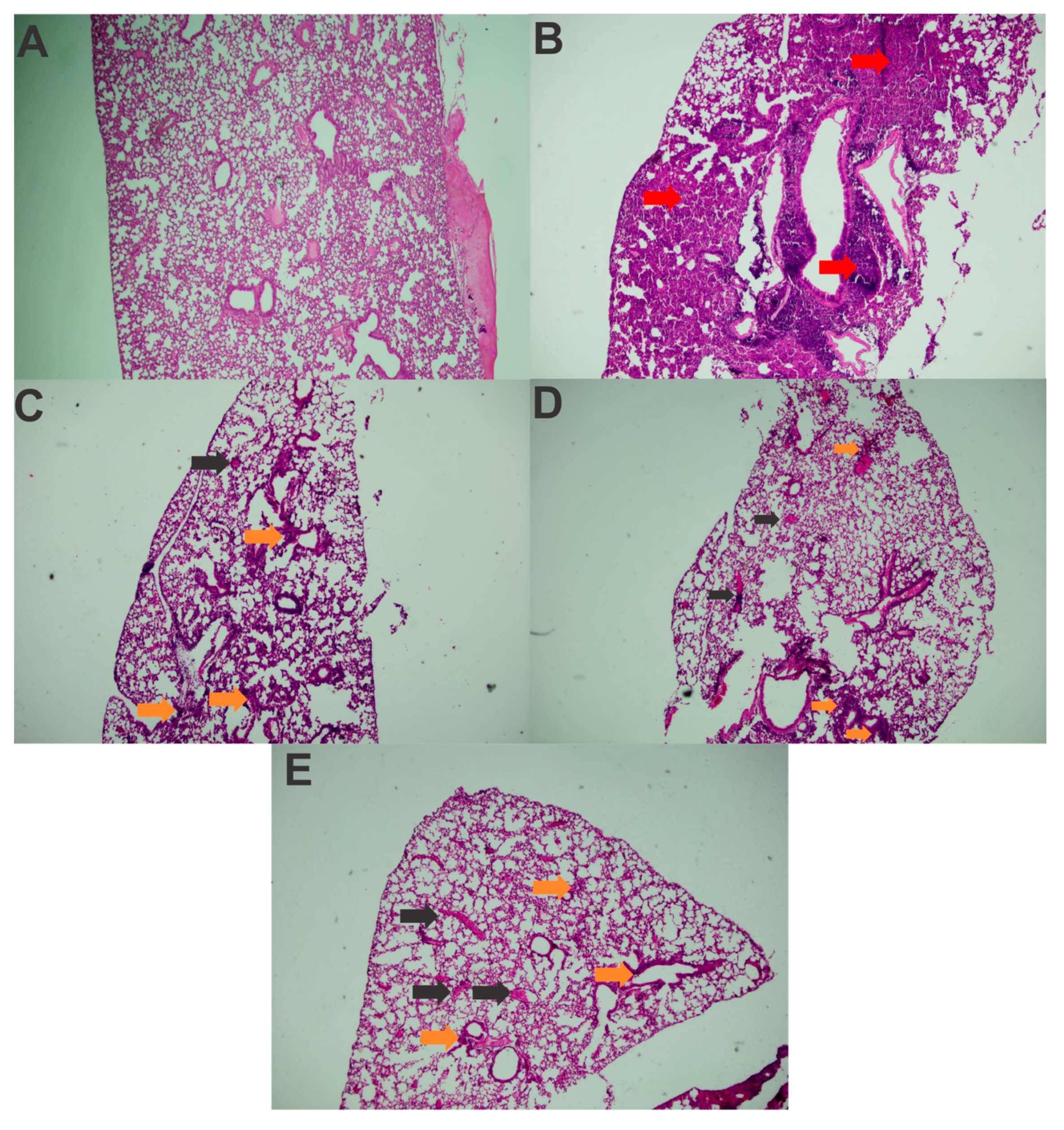 Vaccines 13 00303 g006