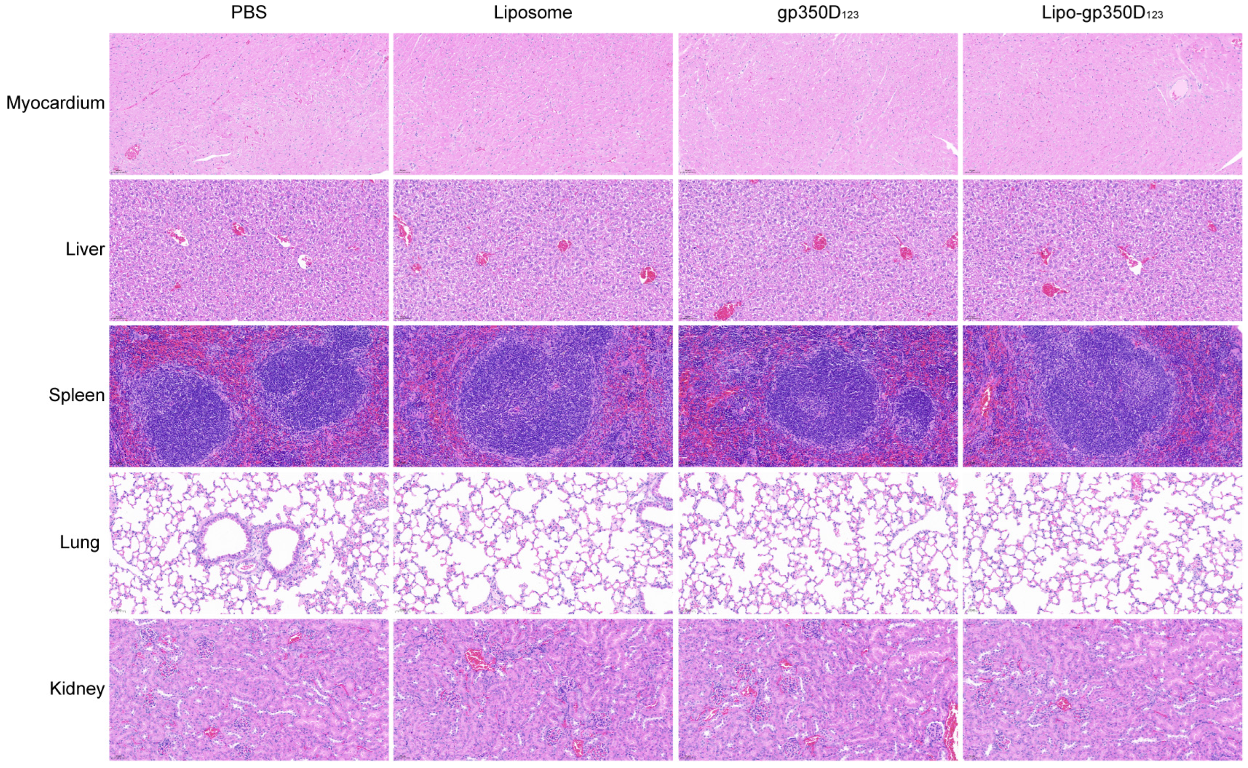 Vaccines 13 00360 g005