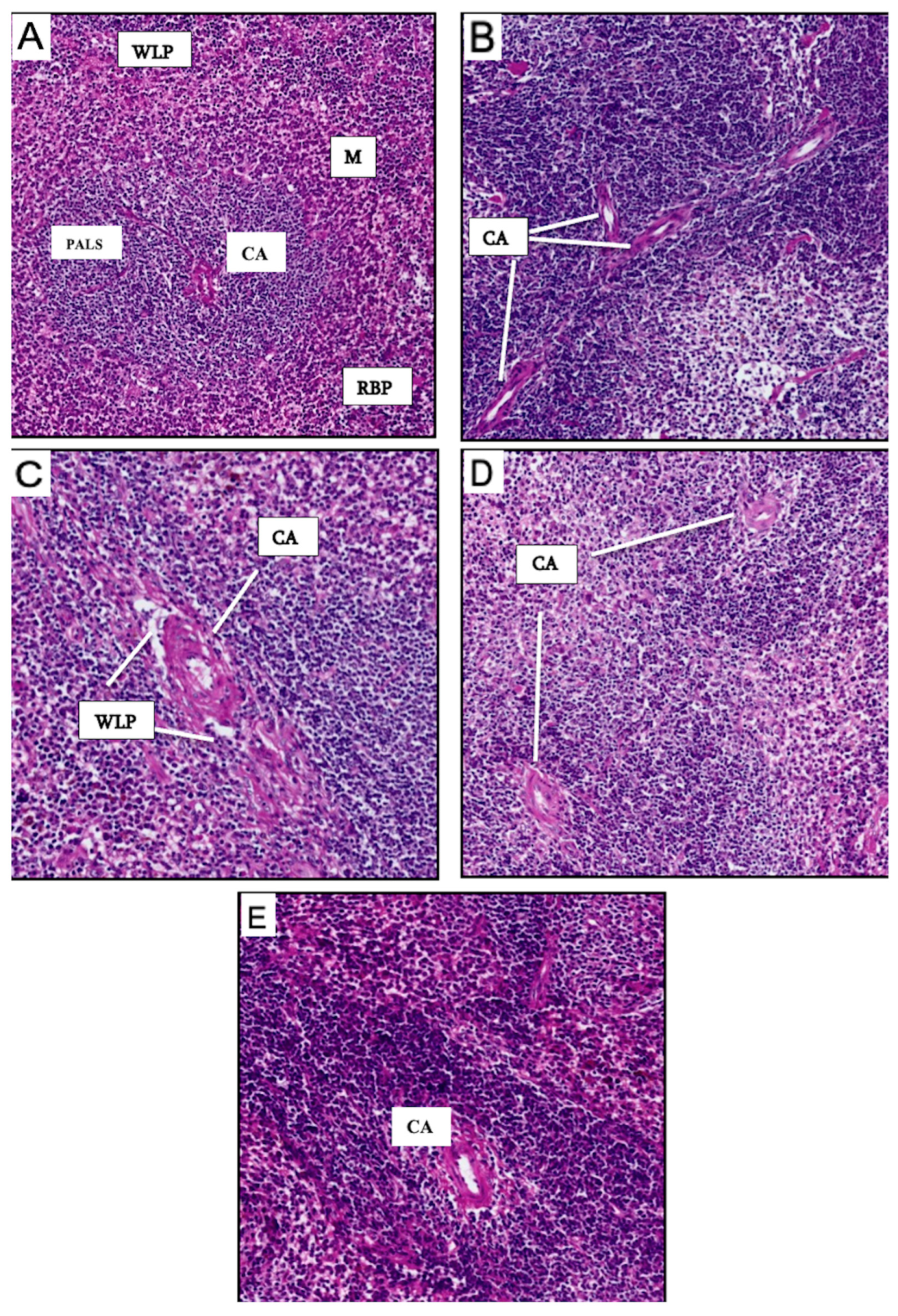 Vaccines 13 00474 g007 Vaccines 13 00474 g007