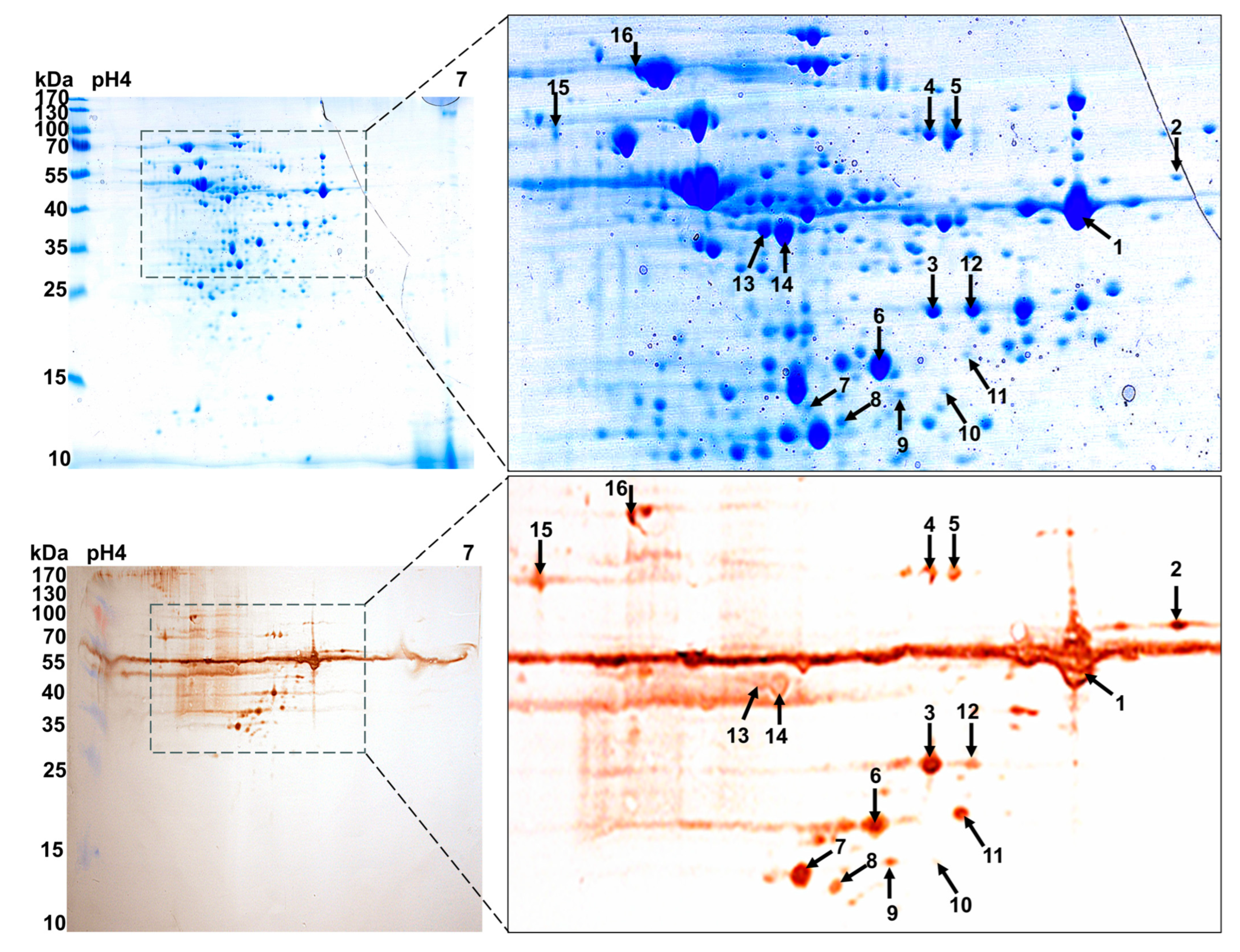 Vaccines 13 01020 g002 Vaccines 13 01020 g002