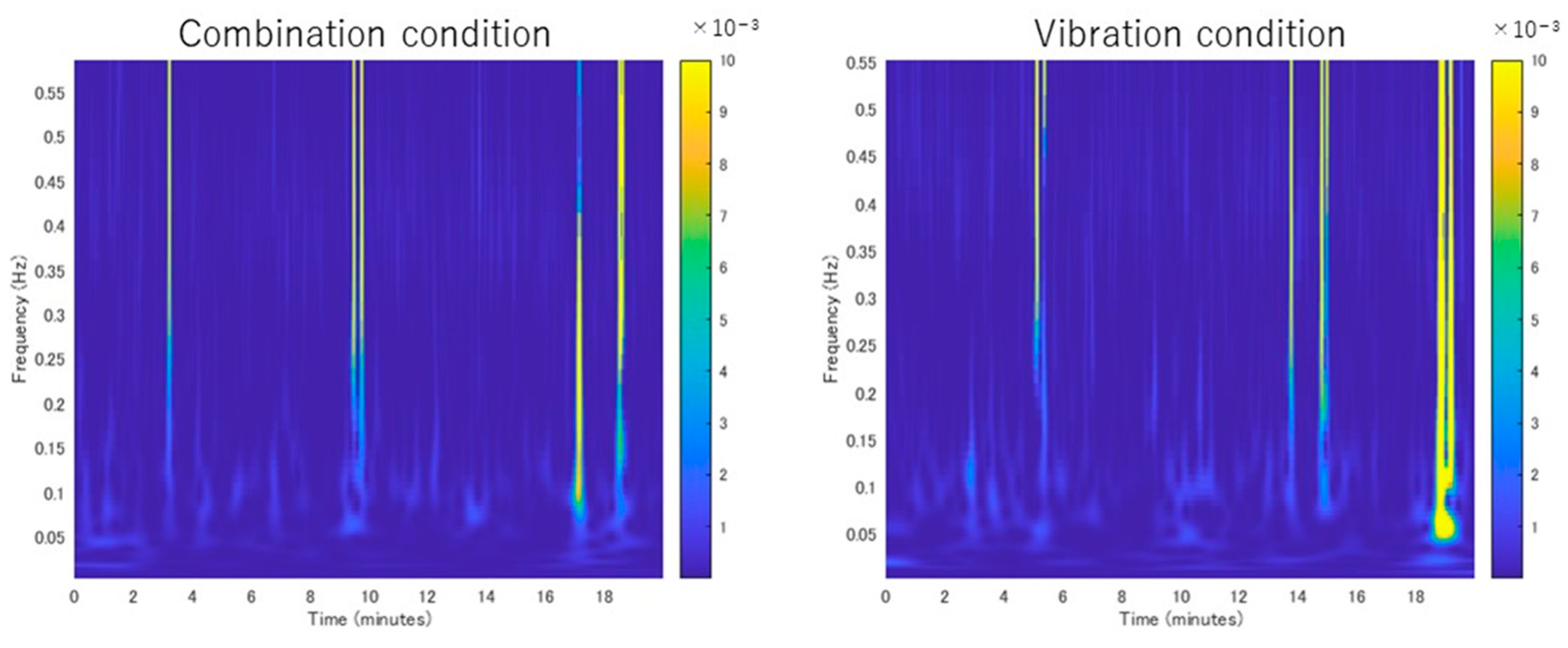 Vibration 07 00042 g004 Vibration 07 00042 g004