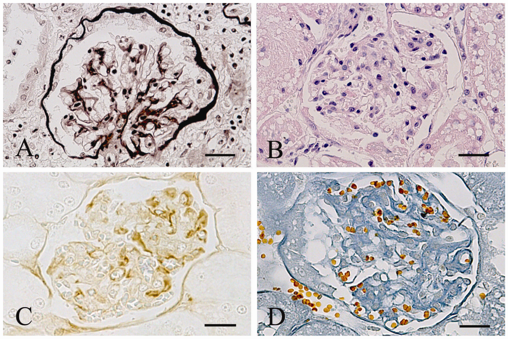 Viruses 04 01372 g002 1024