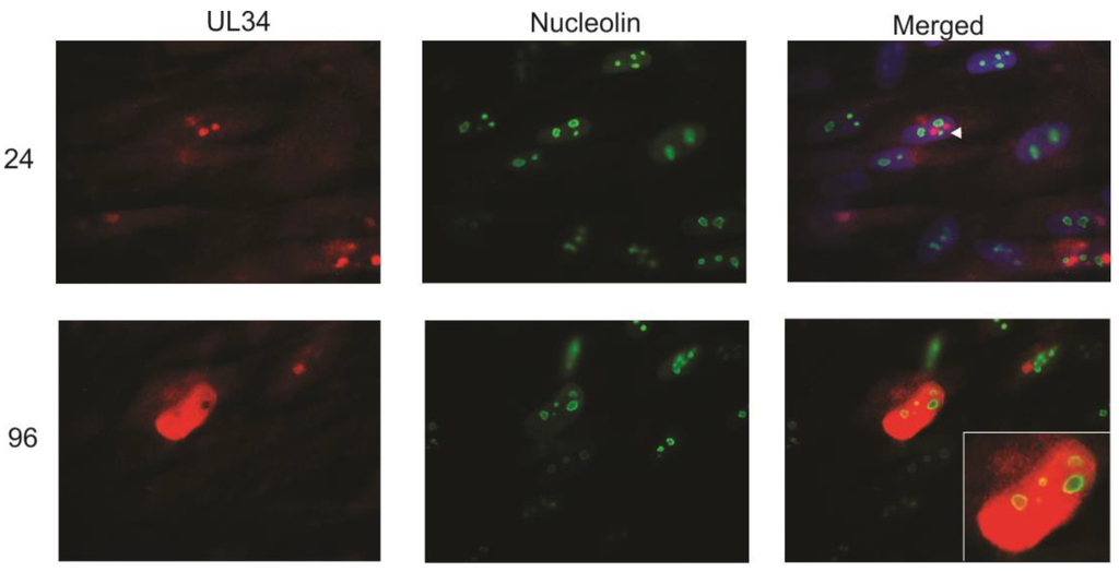 Viruses 06 00476 g005 1024