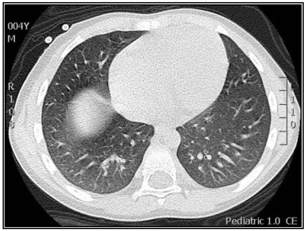 Viruses 06 02038 g004 1024