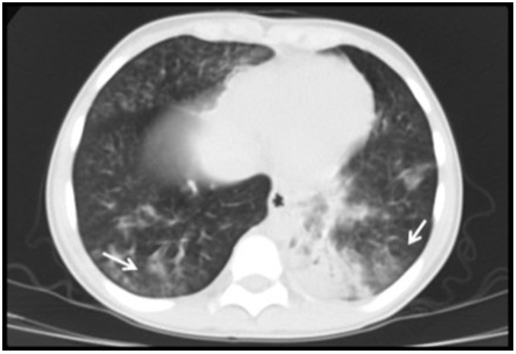 Viruses 06 02038 g005 1024