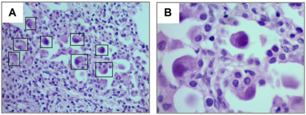 Viruses 06 02038 g006 1024