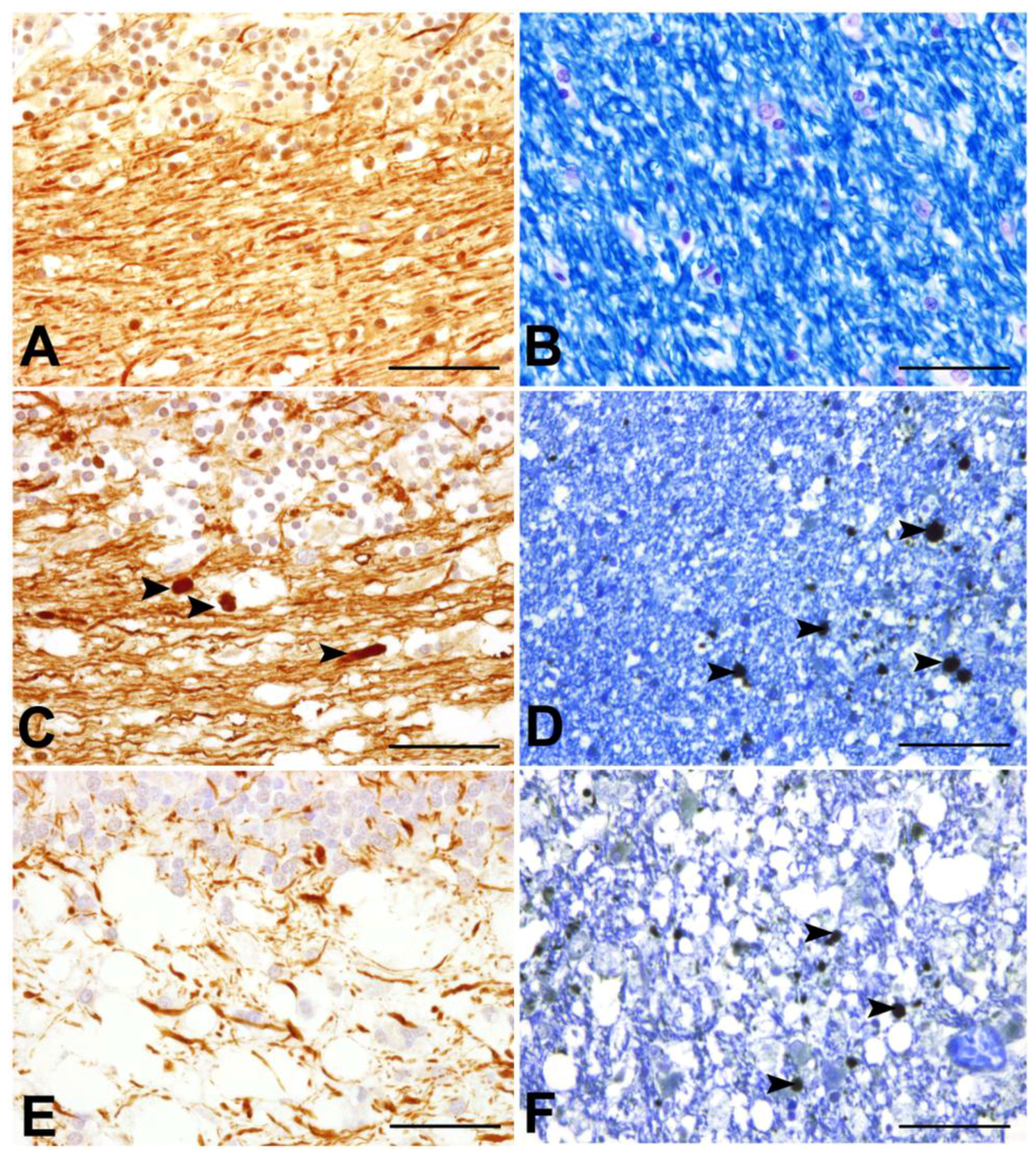 Viruses 06 02571 g004 1024