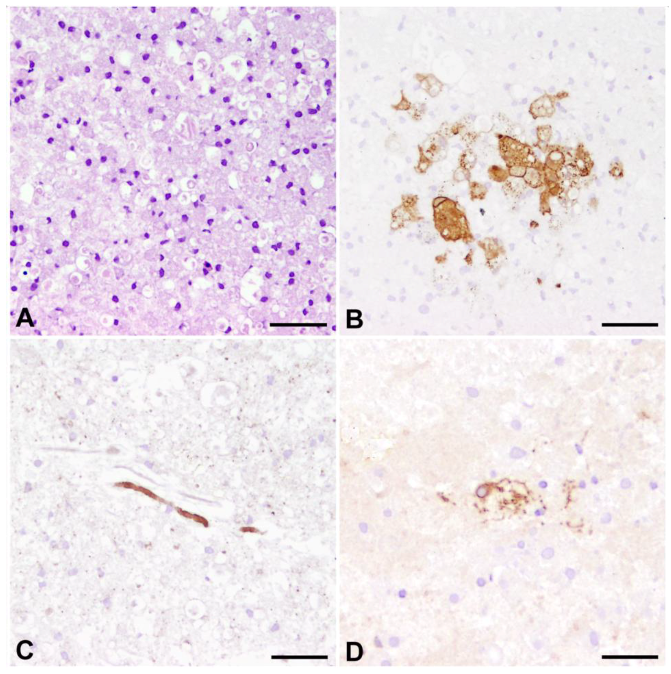 Viruses 06 02571 g006