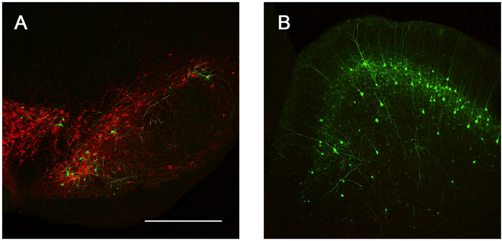 Viruses 06 03293 g007 1024