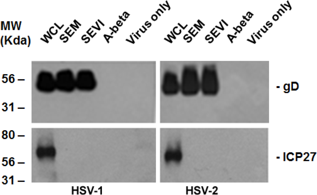 Viruses 07 02057 g001 1024