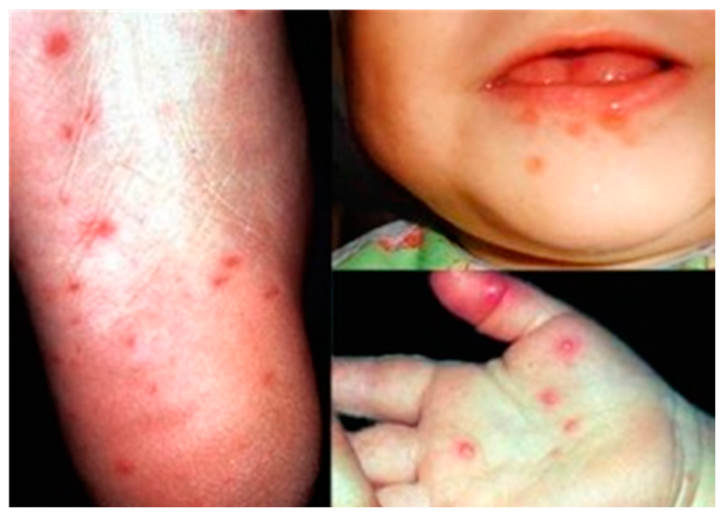 Viruses 08 00001 g002 1024