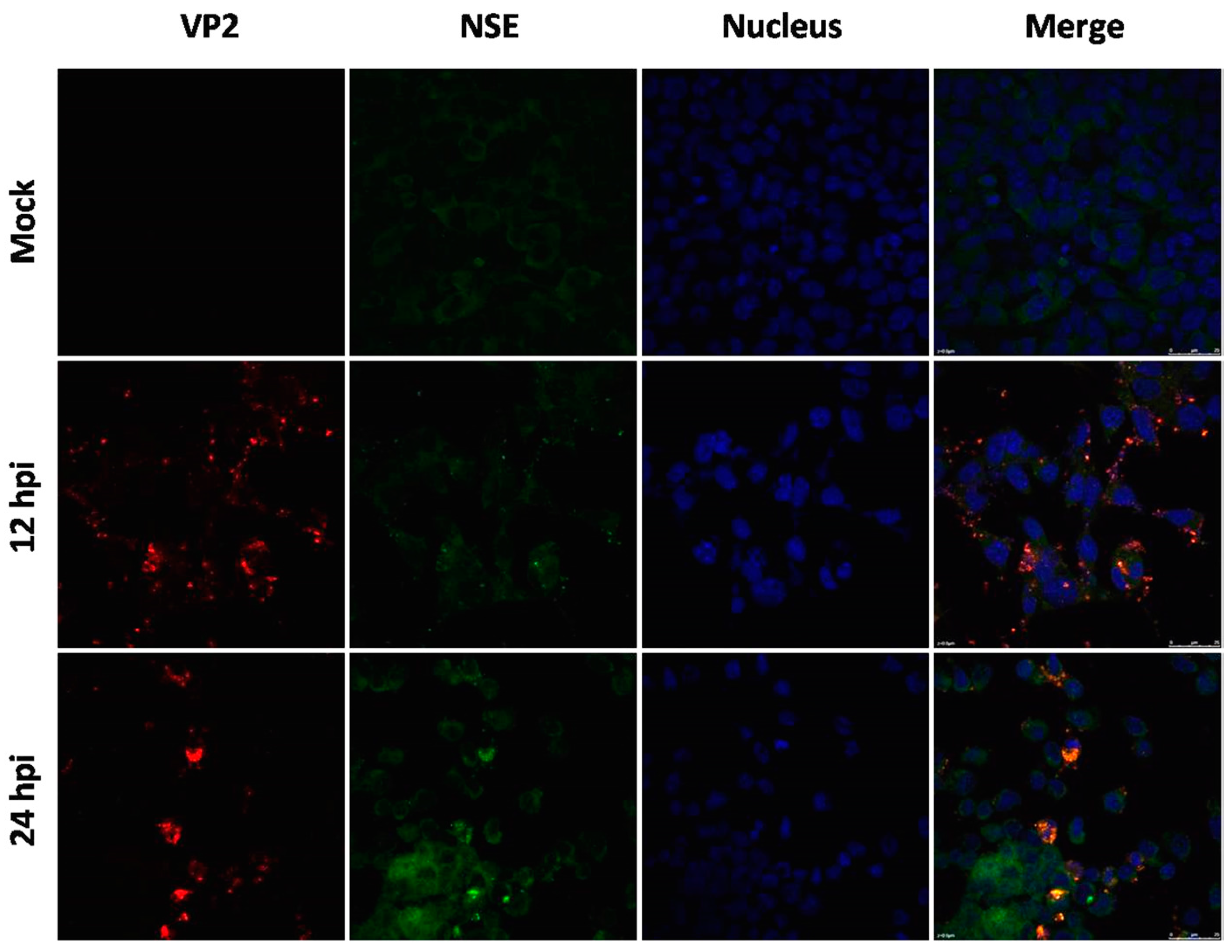 Viruses 09 00351 g004