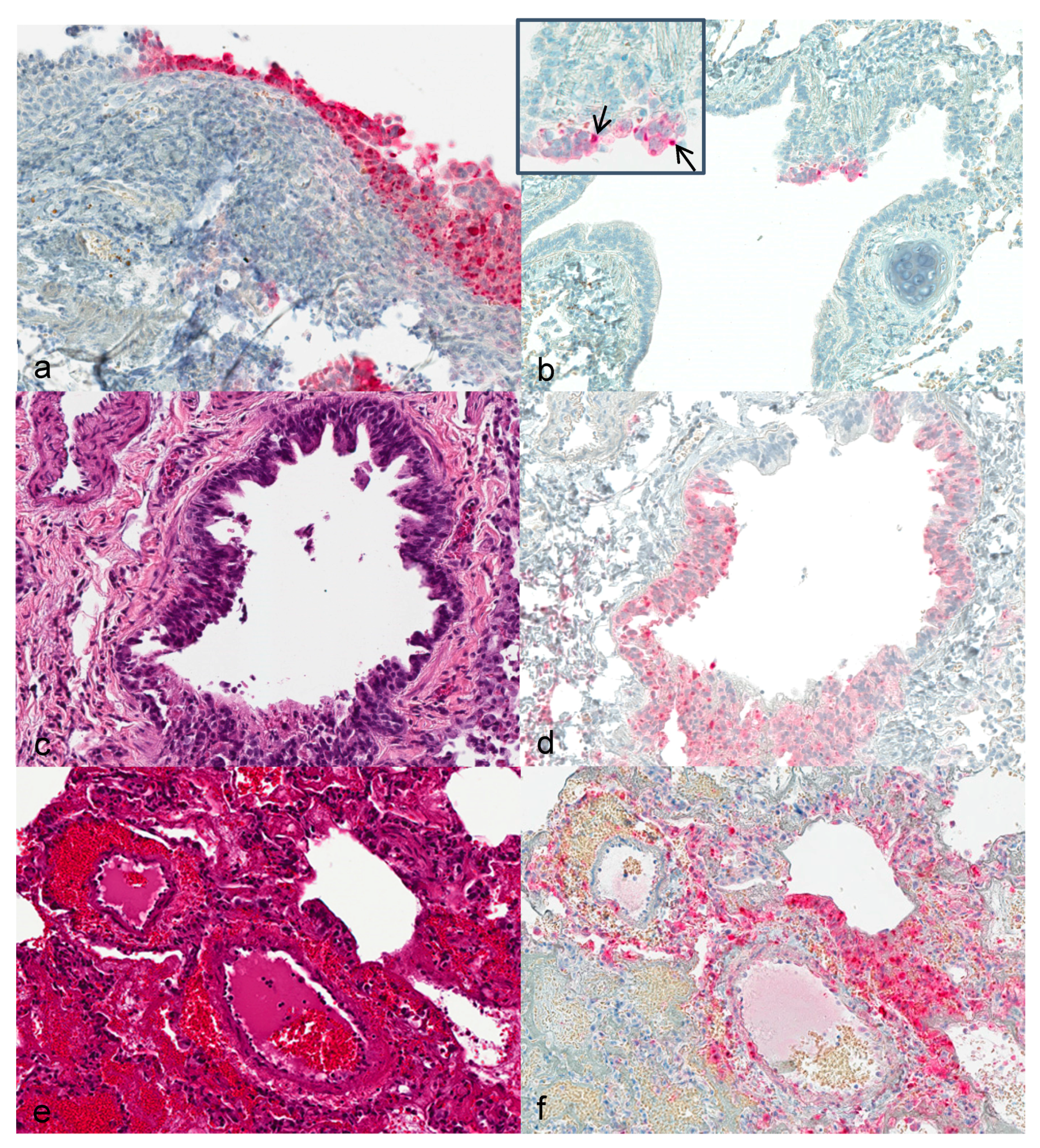 Viruses 09 00363 g001