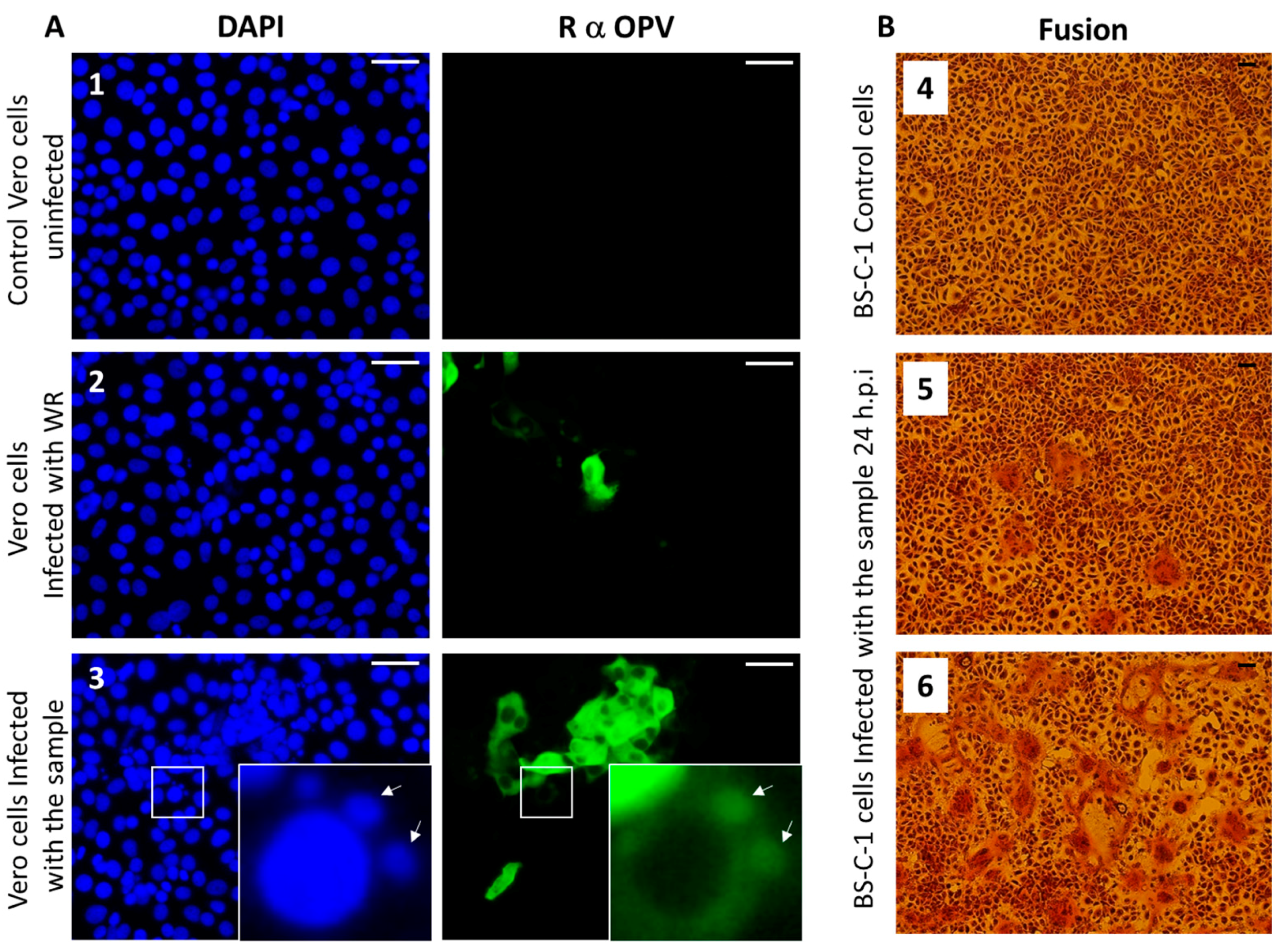 Viruses 10 00078 g004