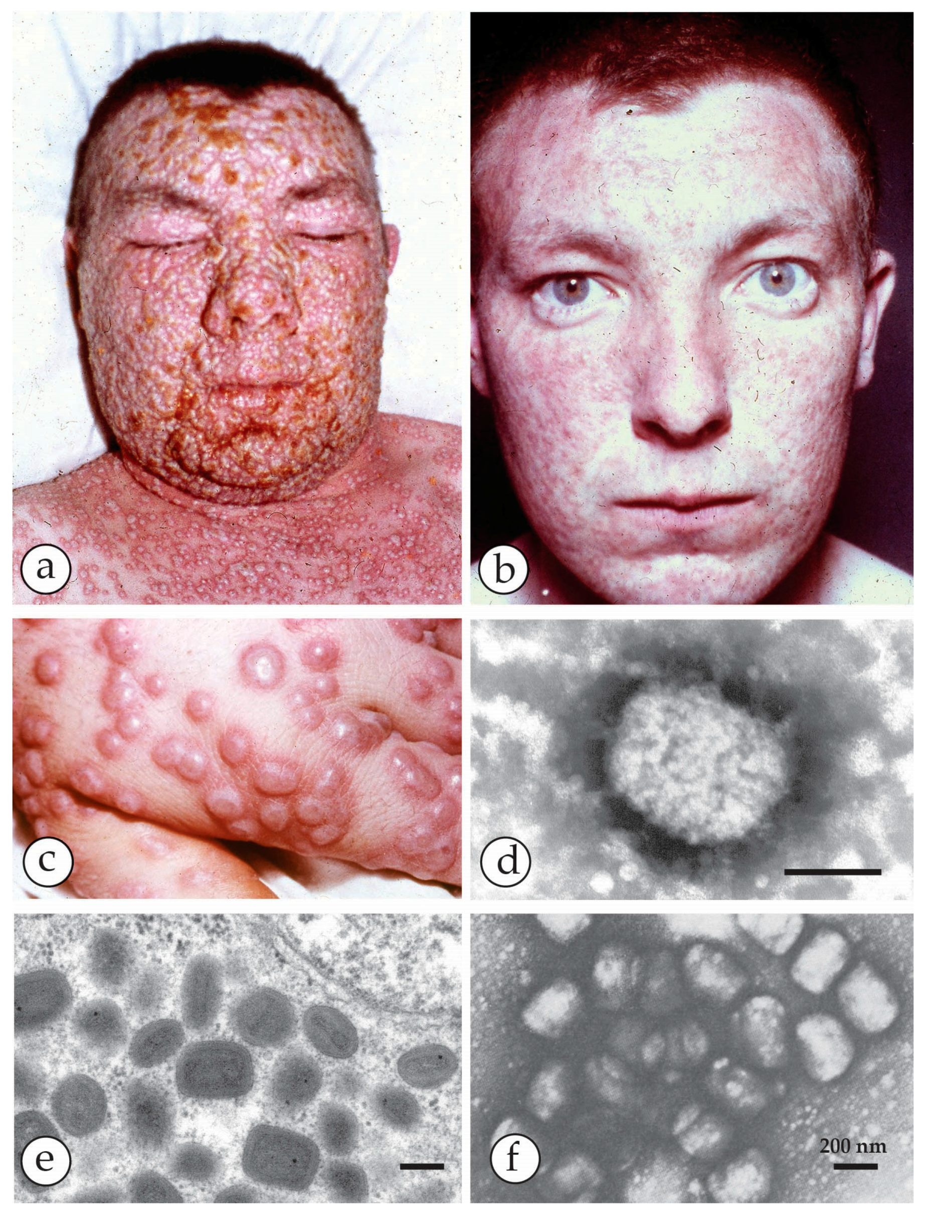 Viruses 10 00142 g001 Viruses 10 00142 g001