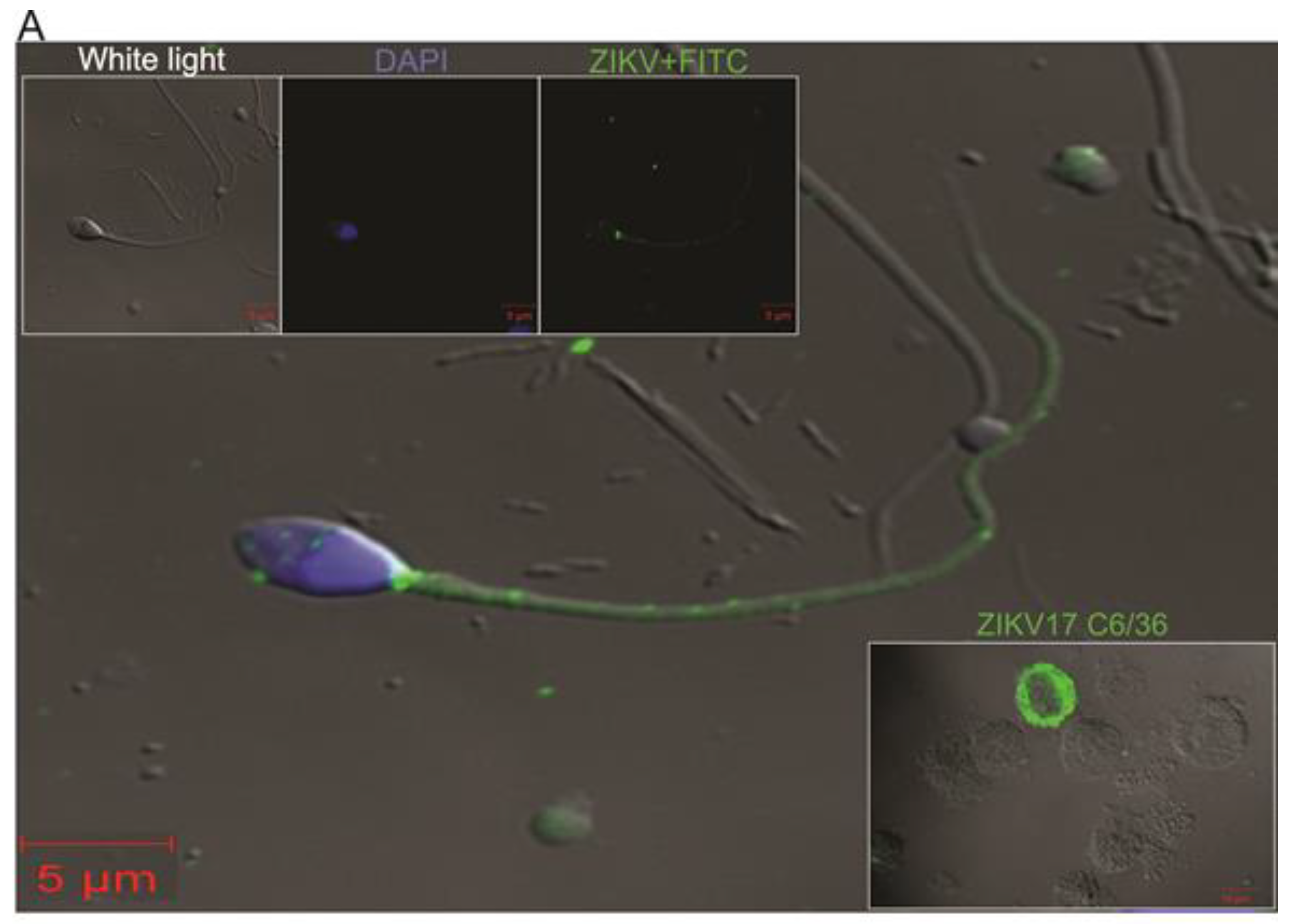 Viruses 10 00615 g003a