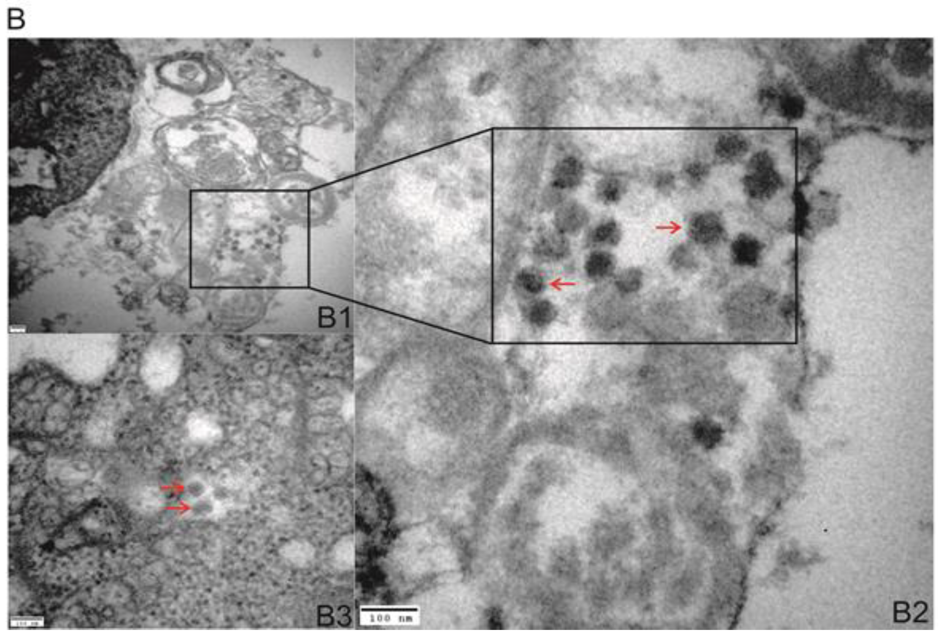 Viruses 10 00615 g003b