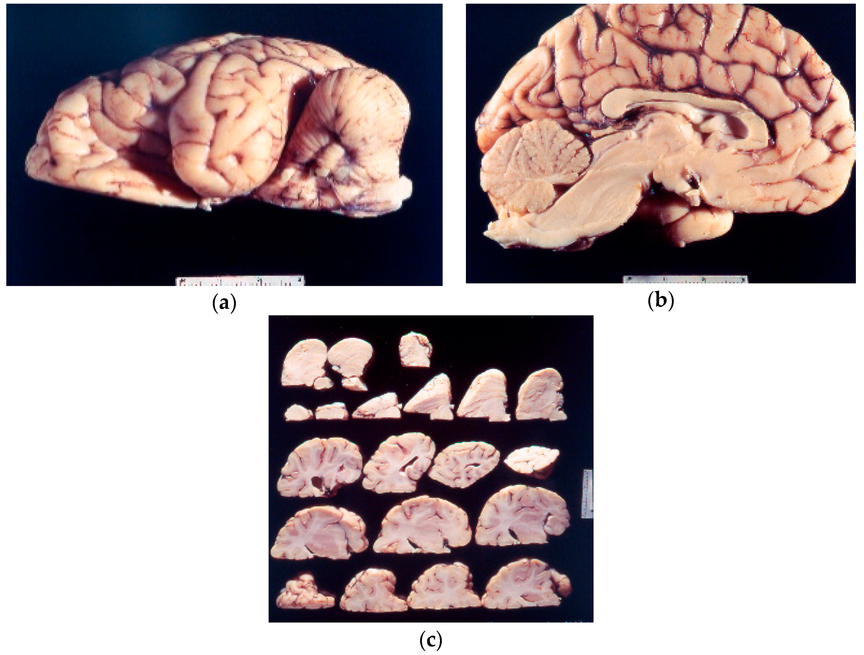 Viruses 11 00232 g005