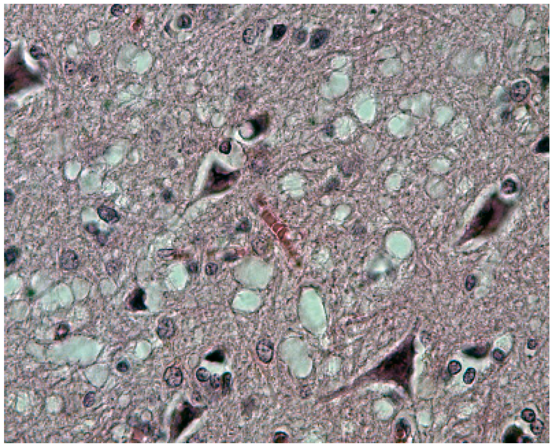 Viruses 11 00232 g014