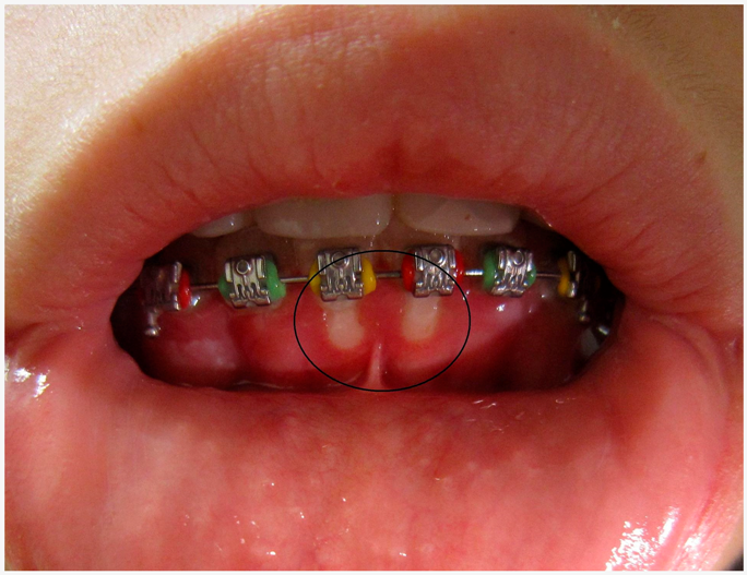 Viruses 11 00463 i001