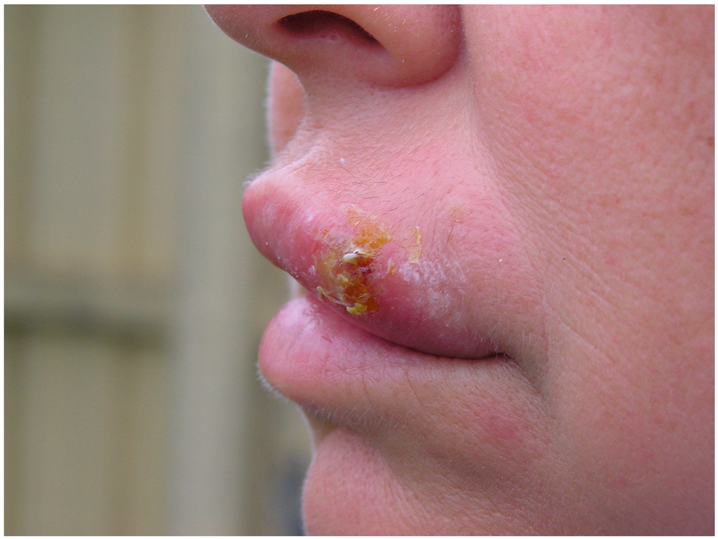 Viruses 11 00463 i002