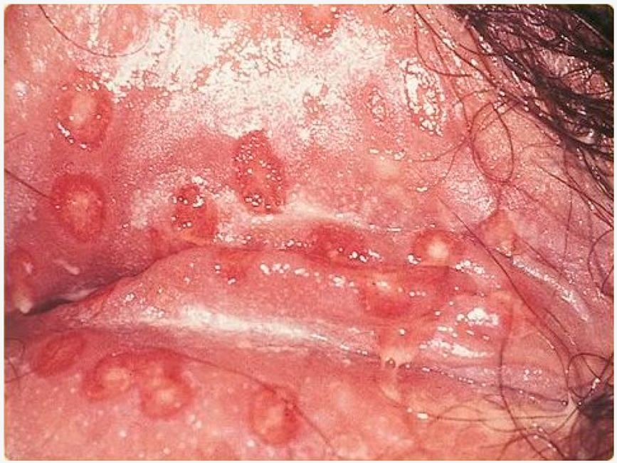 Viruses 11 00463 i003