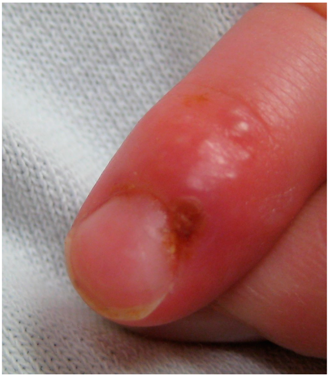 Viruses 11 00463 i004