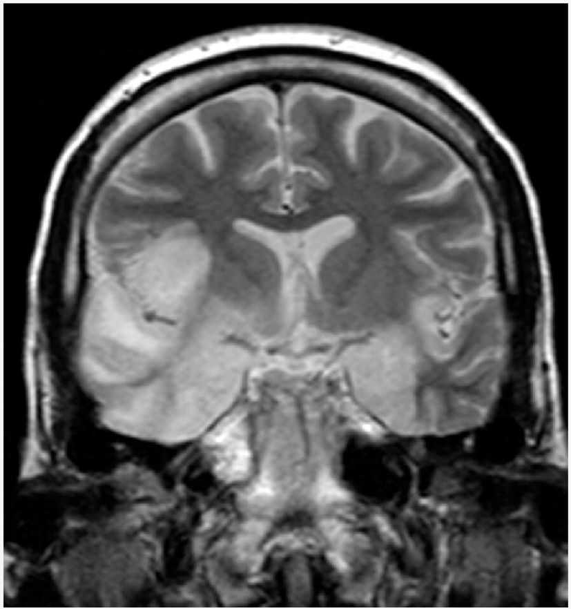 Viruses 11 00463 i005