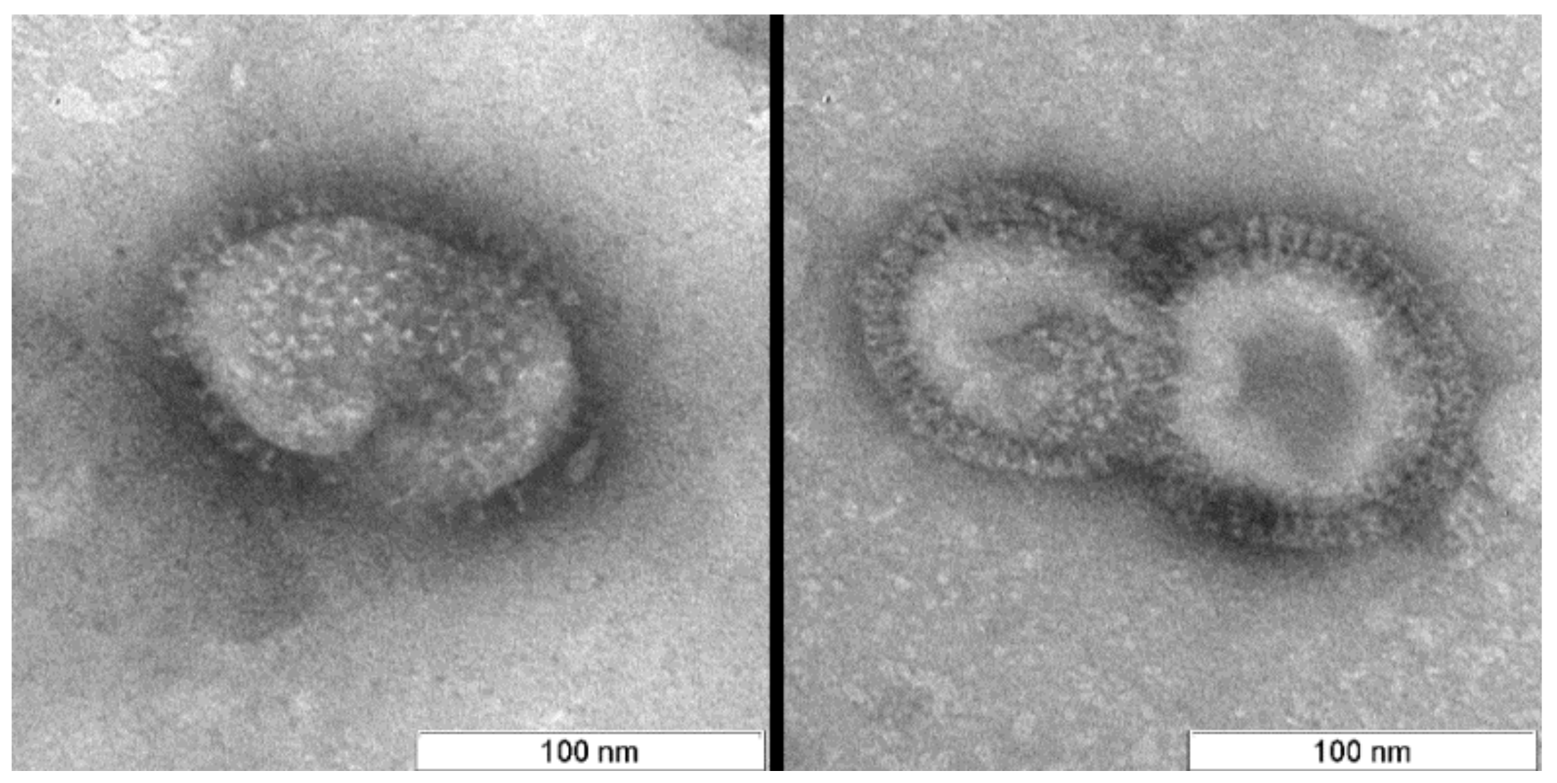 Viruses 11 00955 g003 Viruses 11 00955 g003
