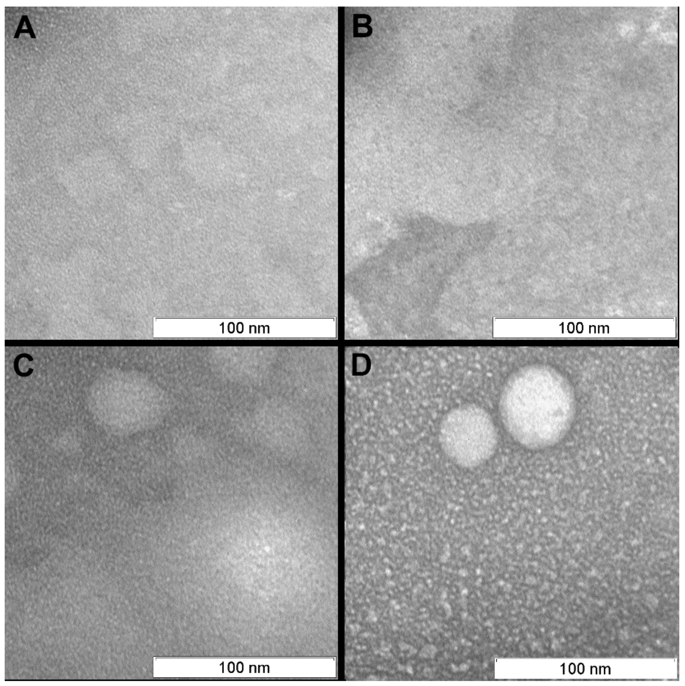 Viruses 11 00955 g007 Viruses 11 00955 g007