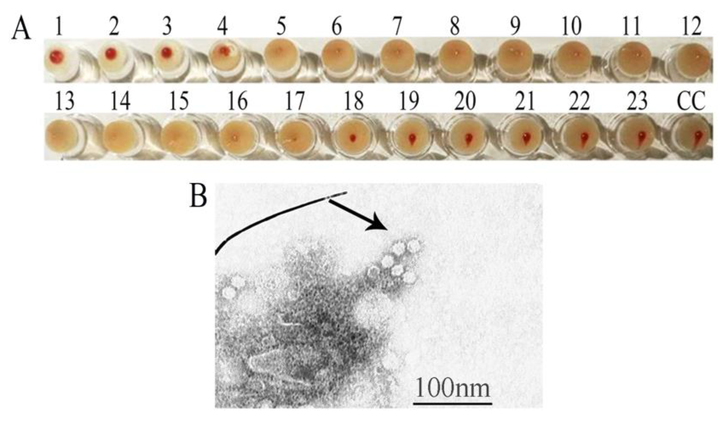 Viruses 12 00315 g002 Viruses 12 00315 g002
