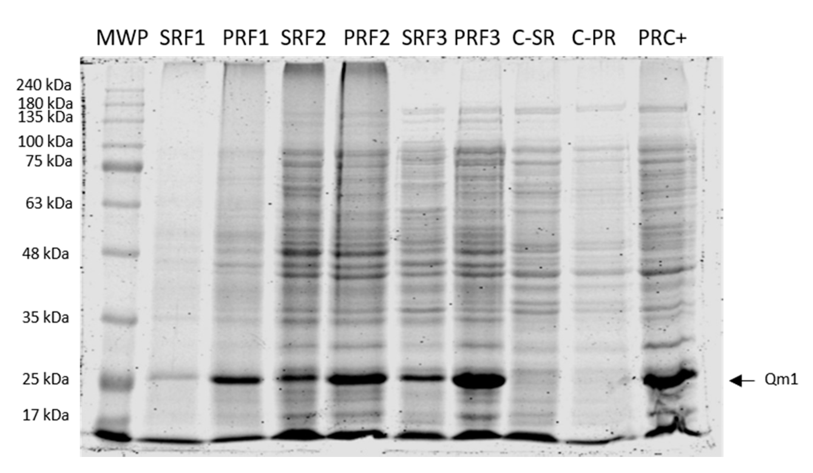 Viruses 12 00385 g008 Viruses 12 00385 g008