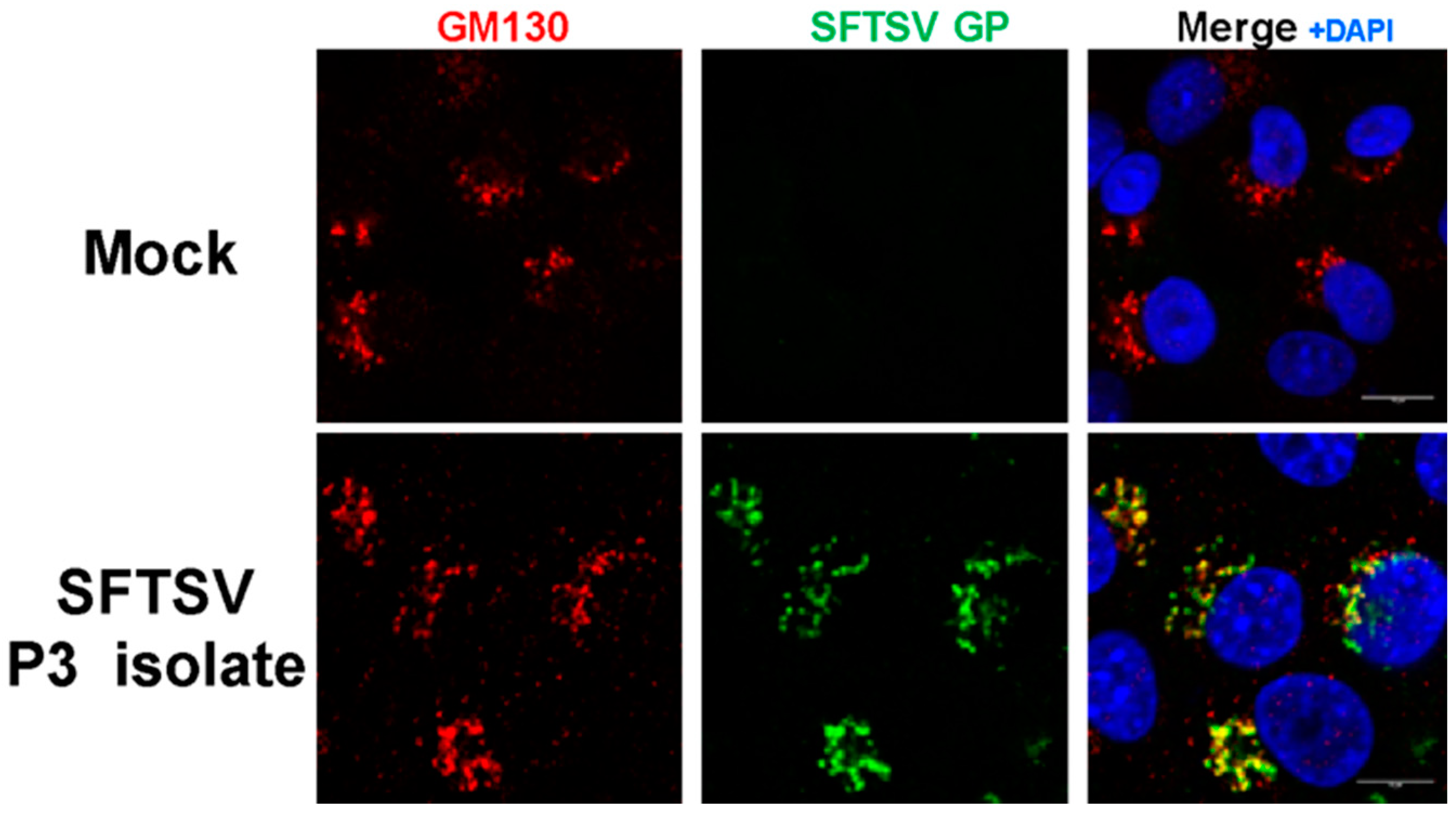 Viruses 12 00958 g002