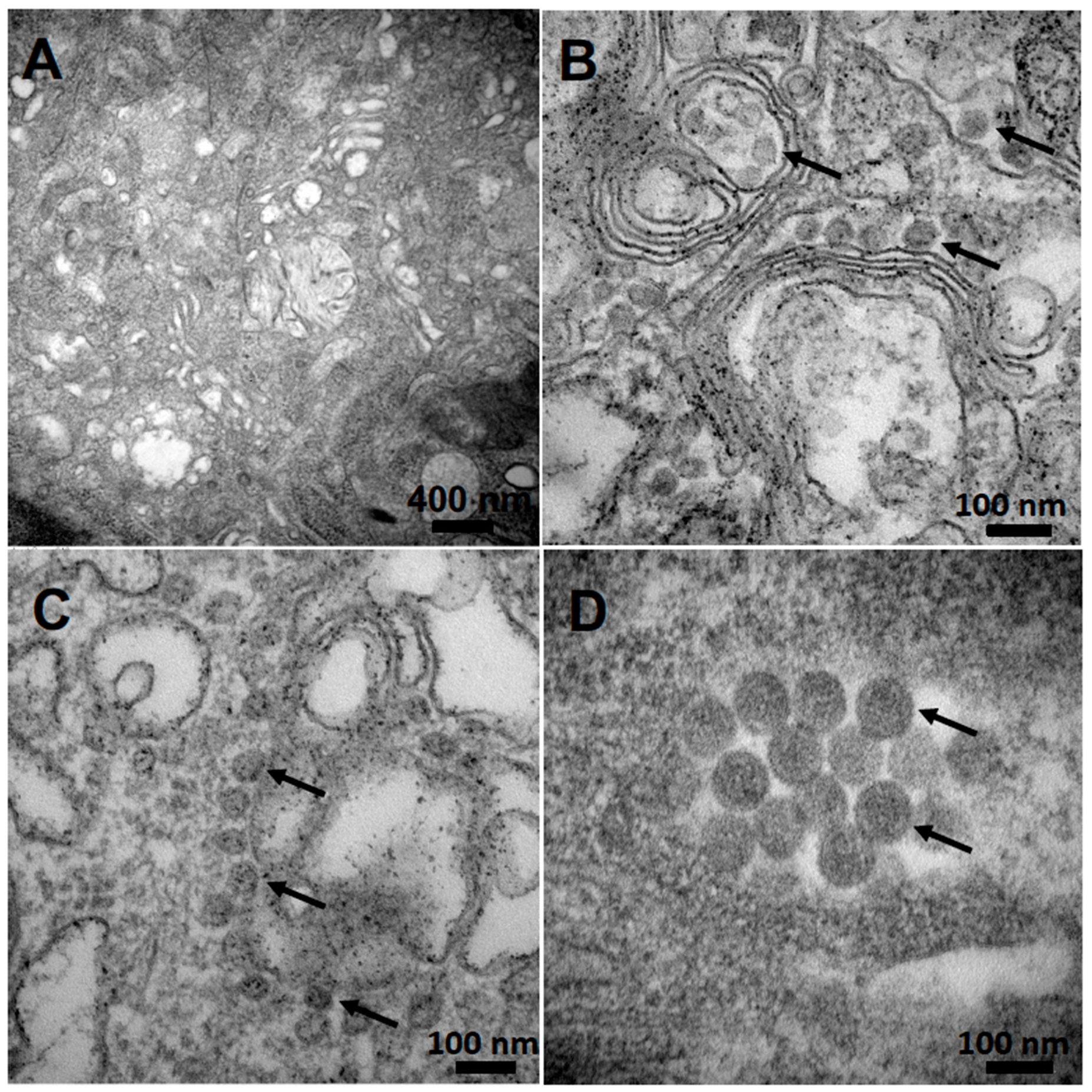 Viruses 12 00958 g003