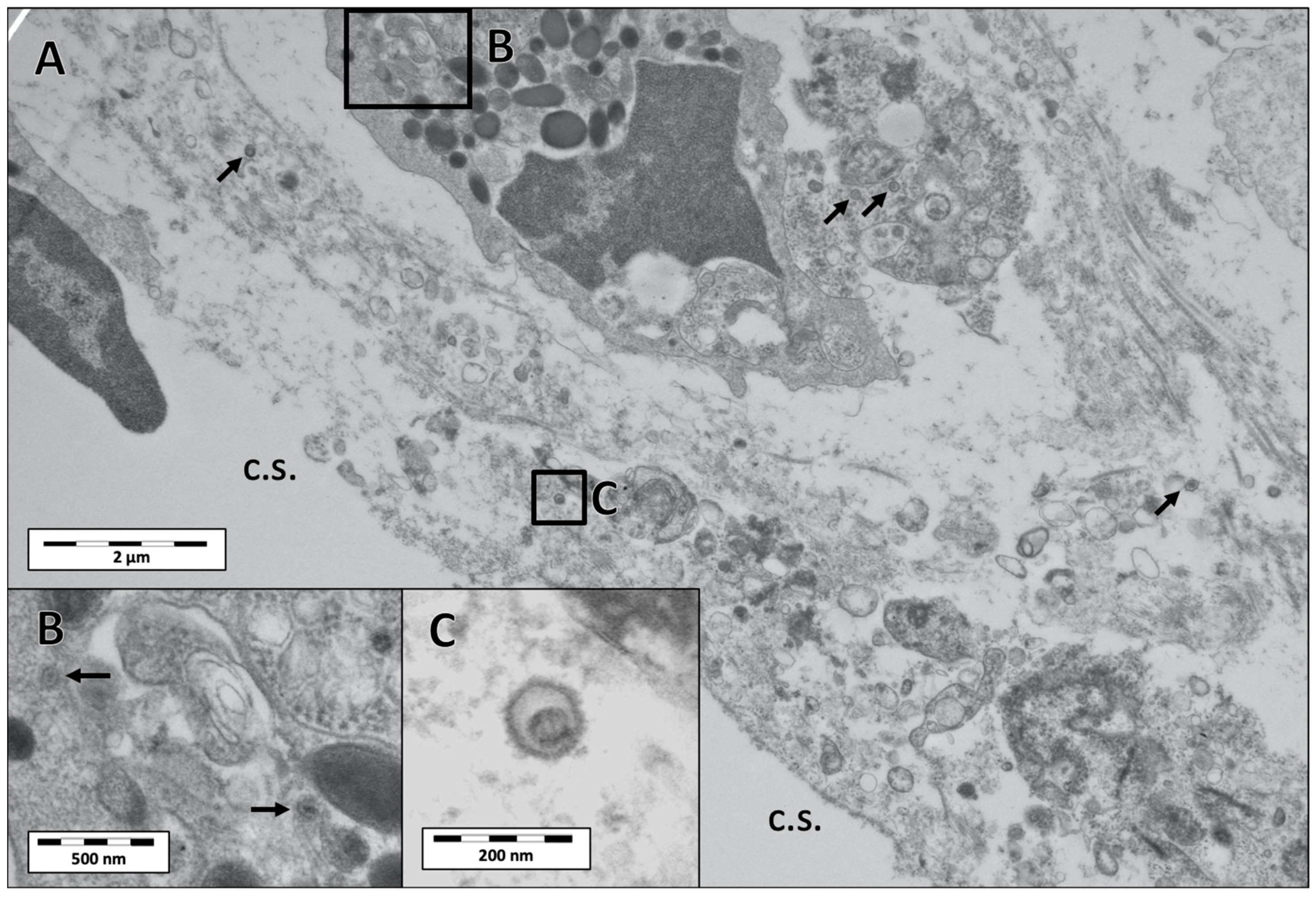 Viruses 12 01007 g005