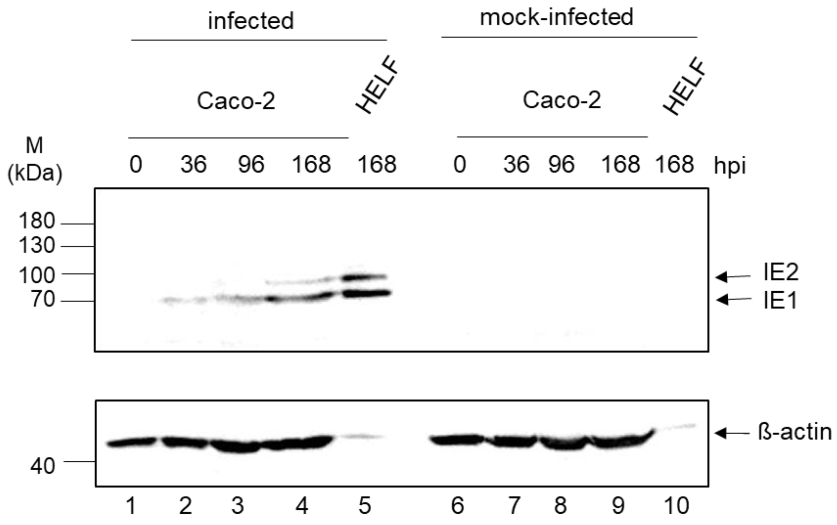 Viruses 13 00083 g004