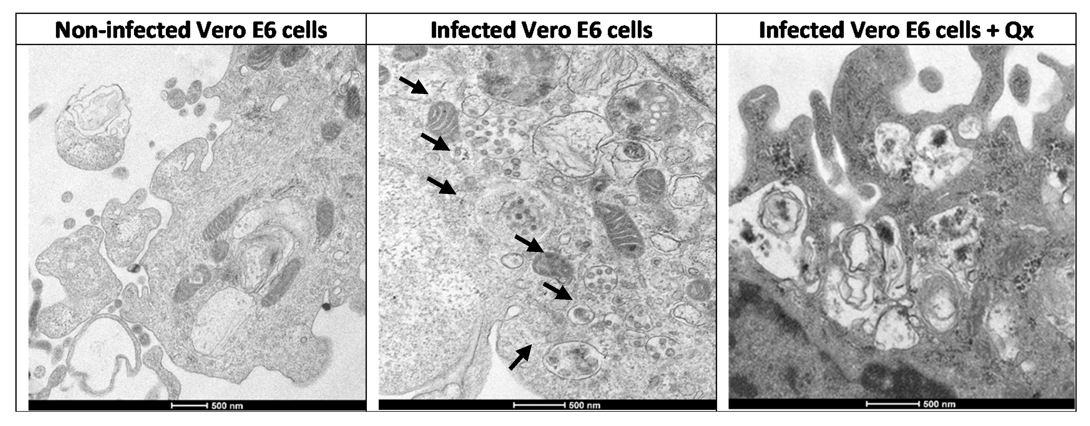 Viruses 13 00121 g005